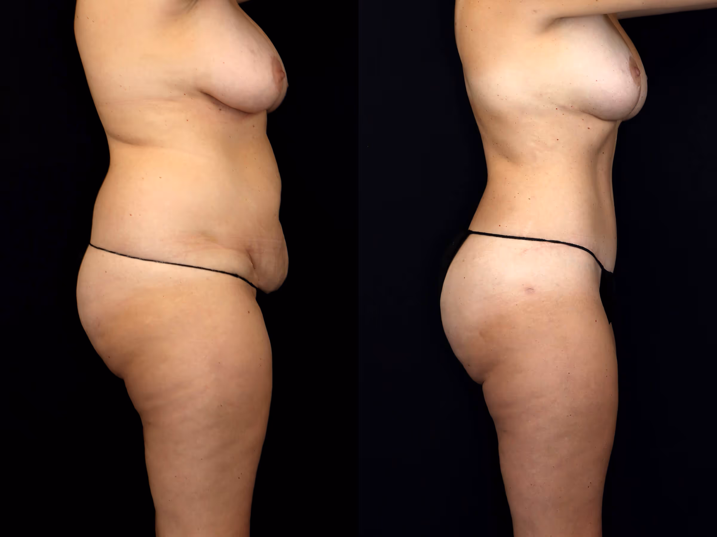 Before And After Patient Image