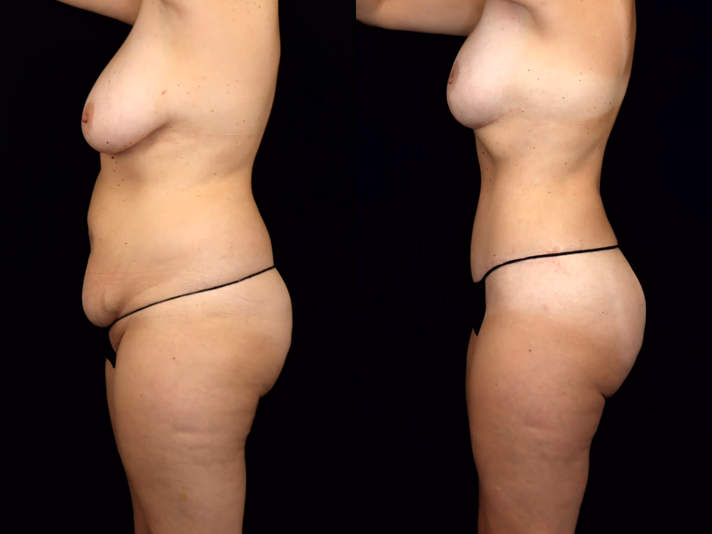 Before And After Patient Image