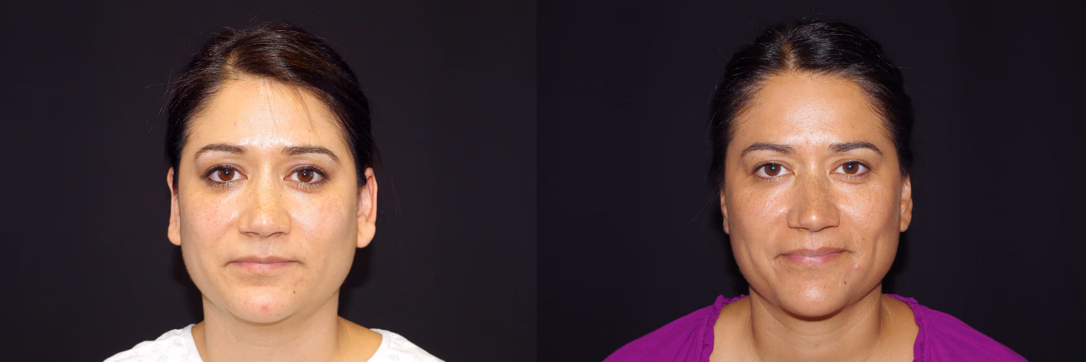 Before And After Patient Image