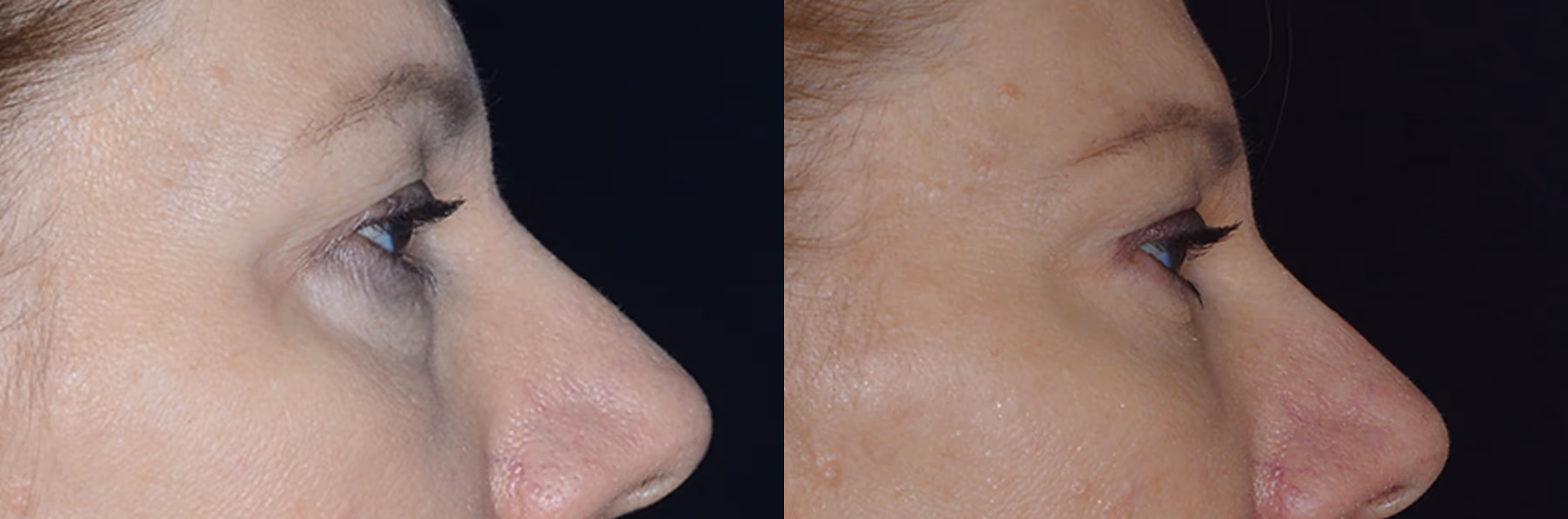 Before And After Patient Image