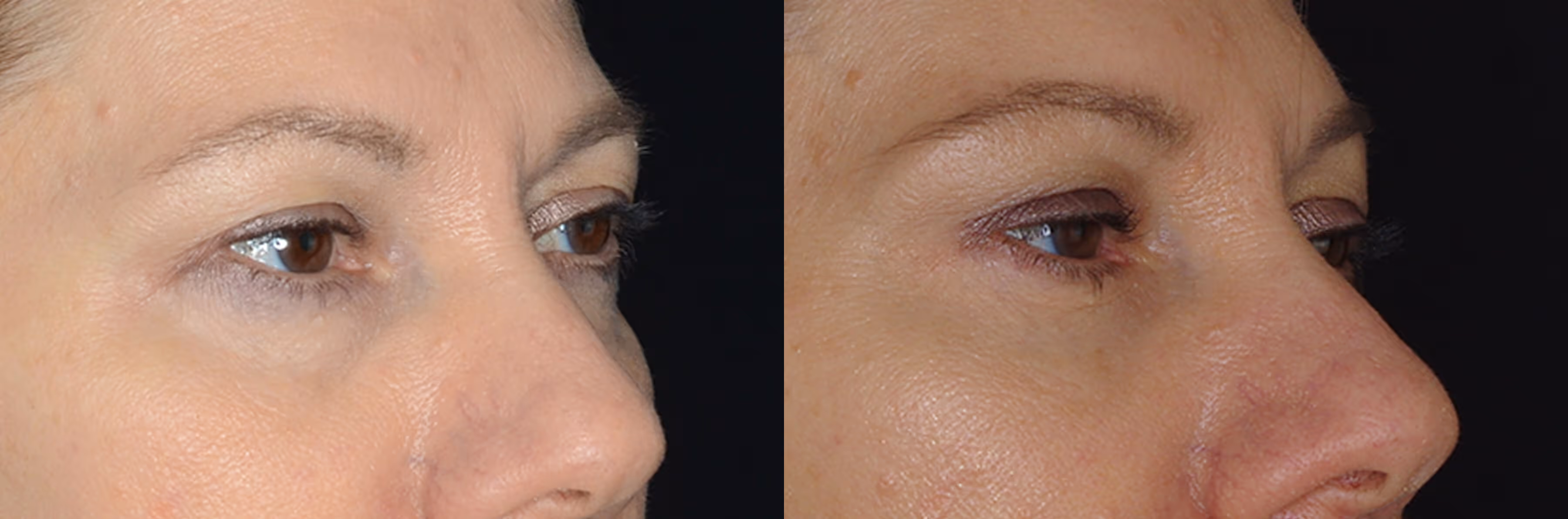 Before And After Patient Image