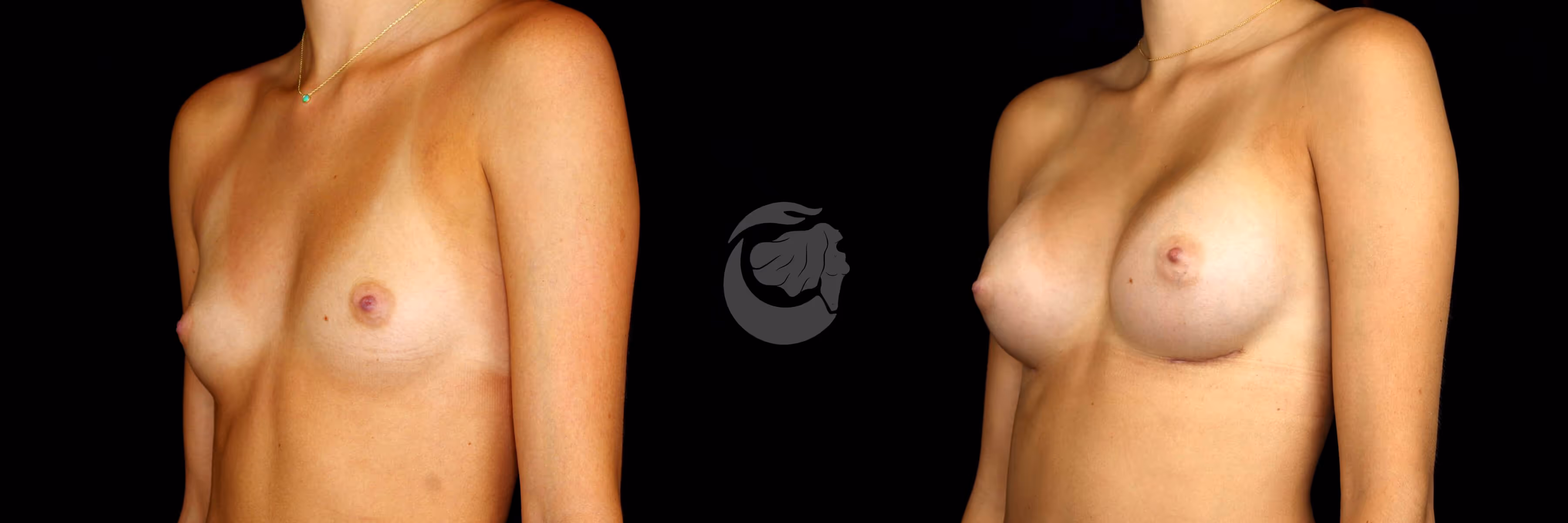 Before And After Patient Image