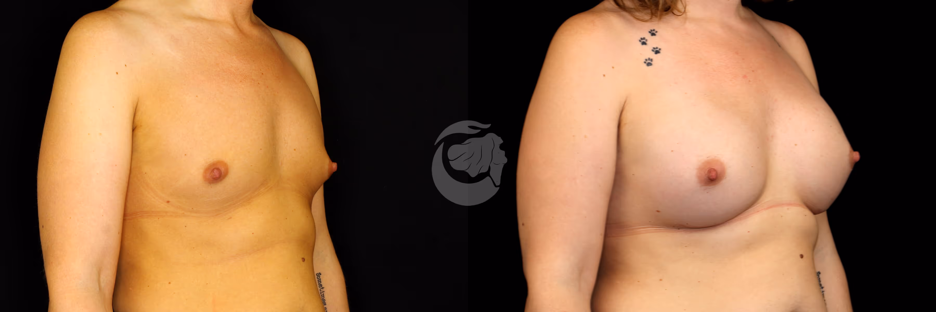 Before And After Patient Image