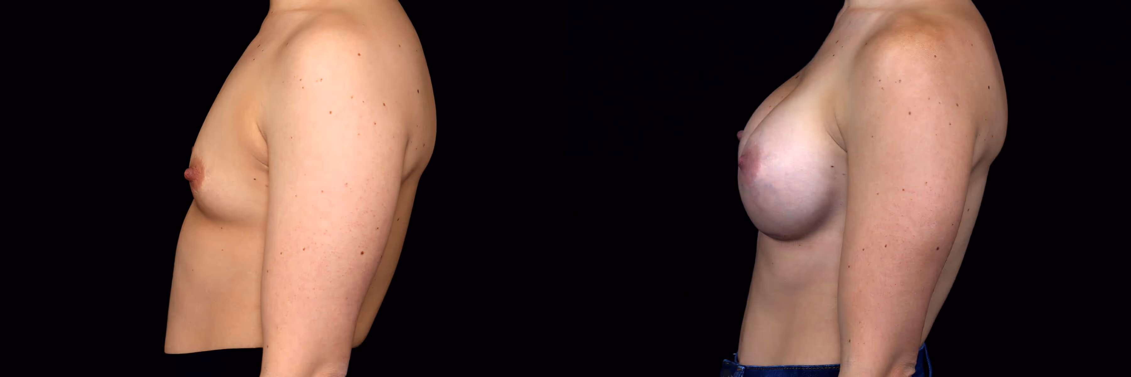 Before And After Patient Image