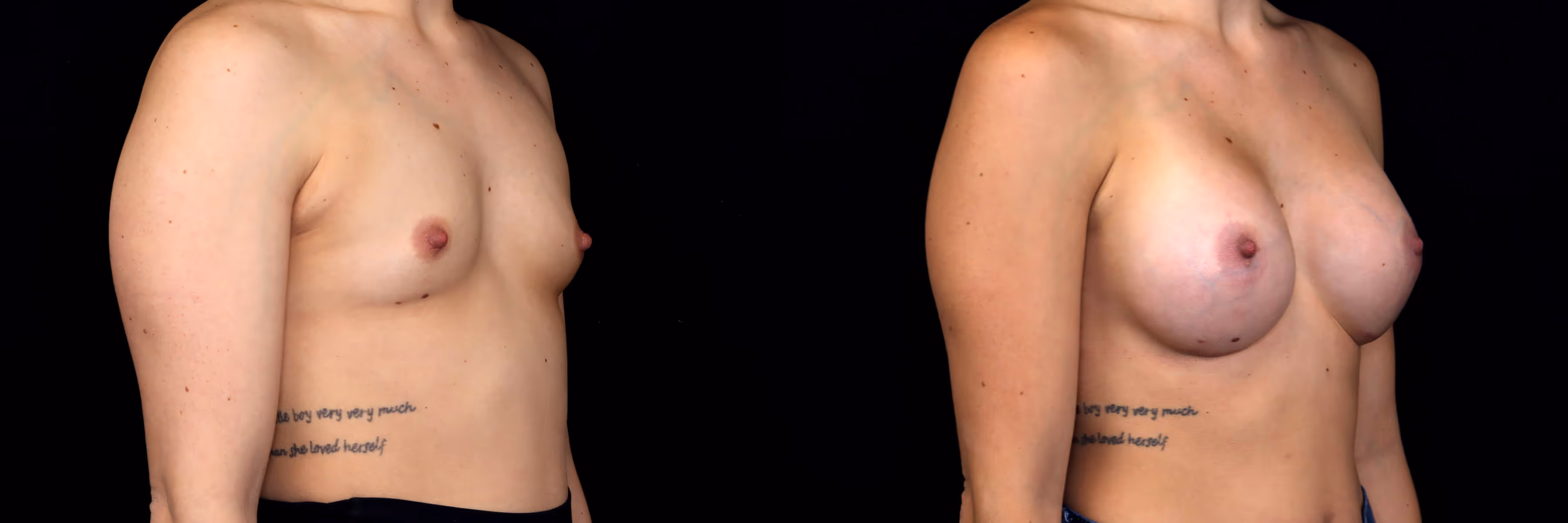 Before And After Patient Image