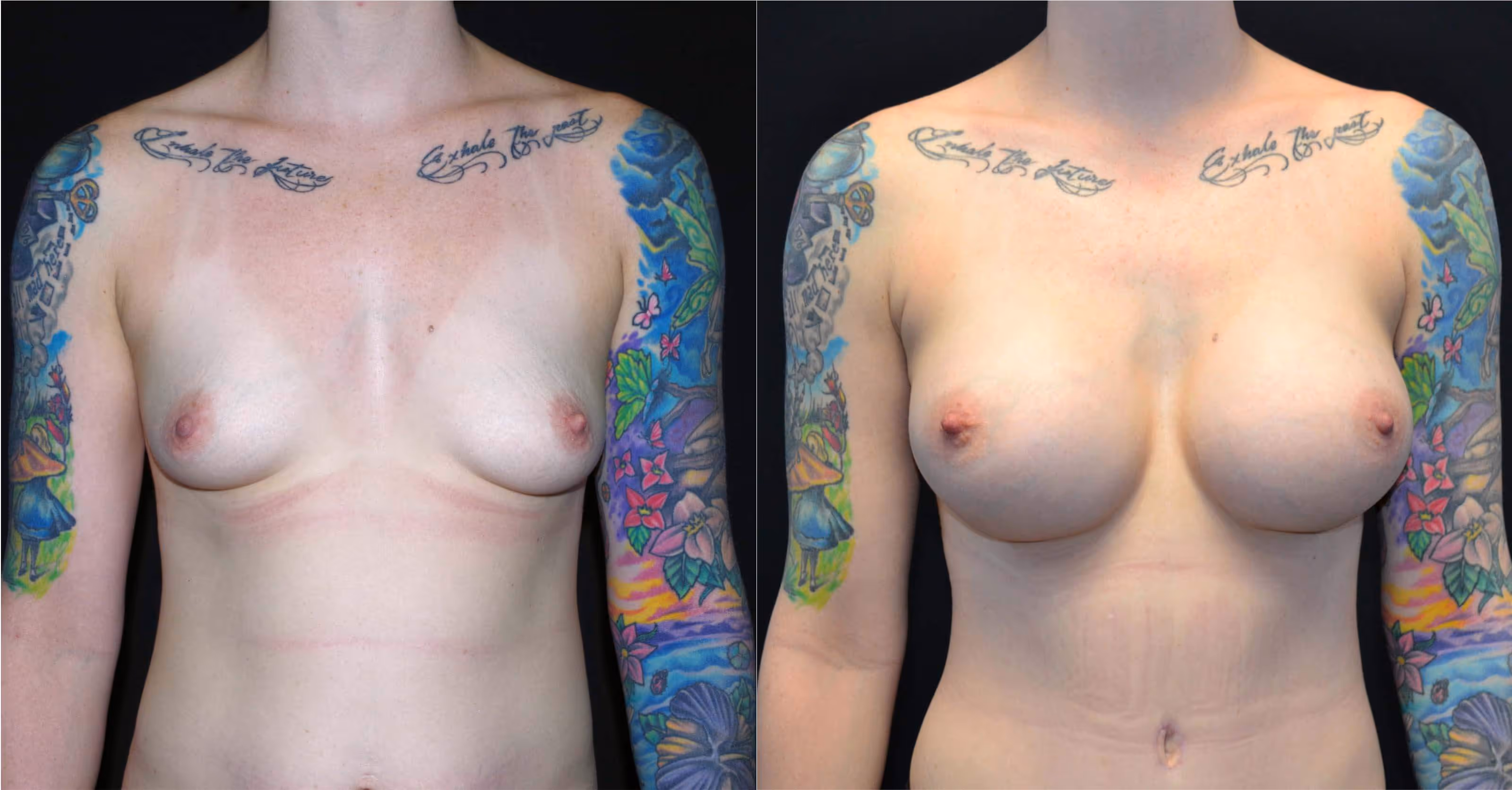 Before And After Patient Image