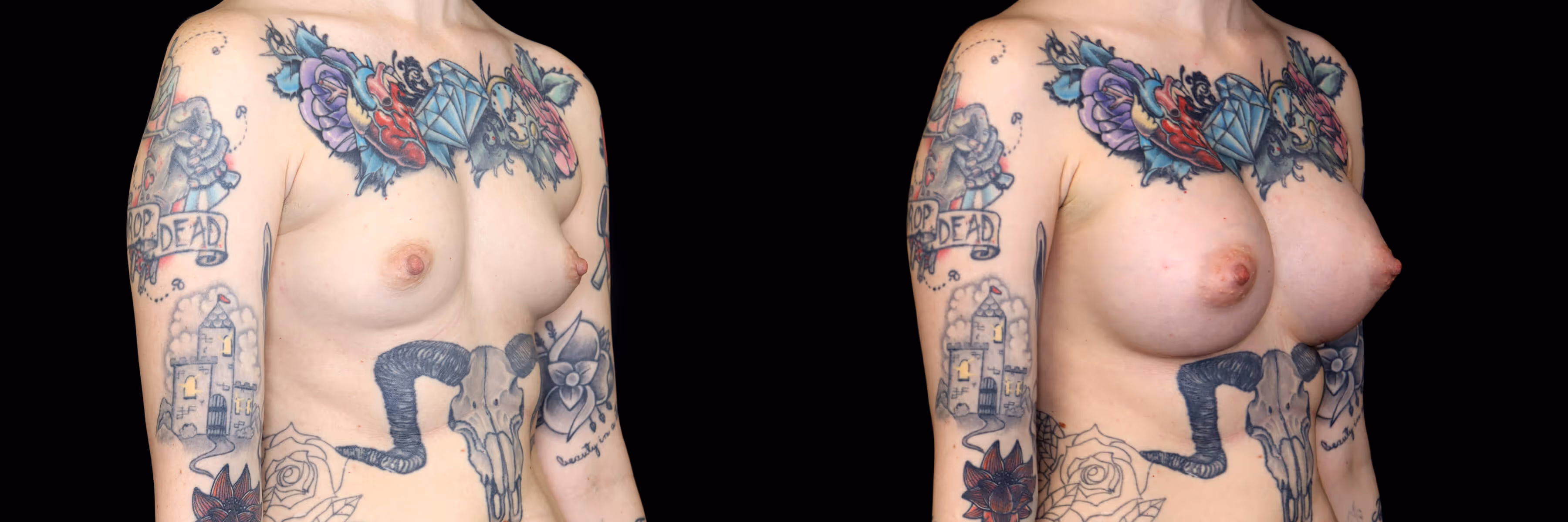Before And After Patient Image