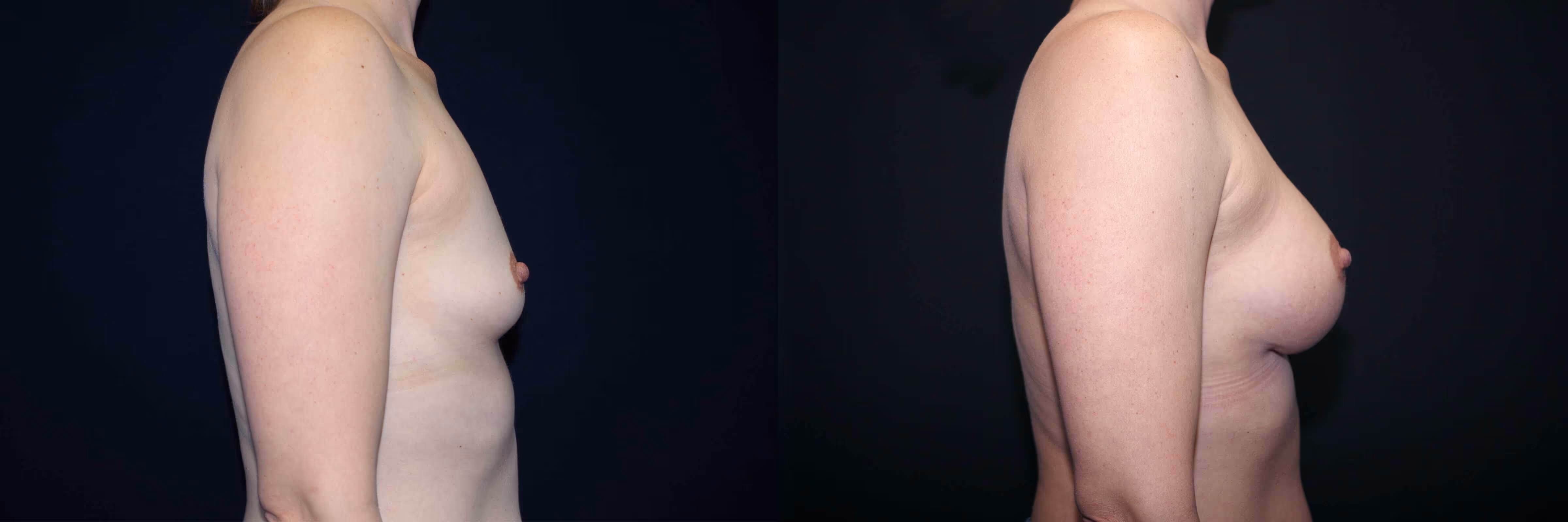 Before And After Patient Image
