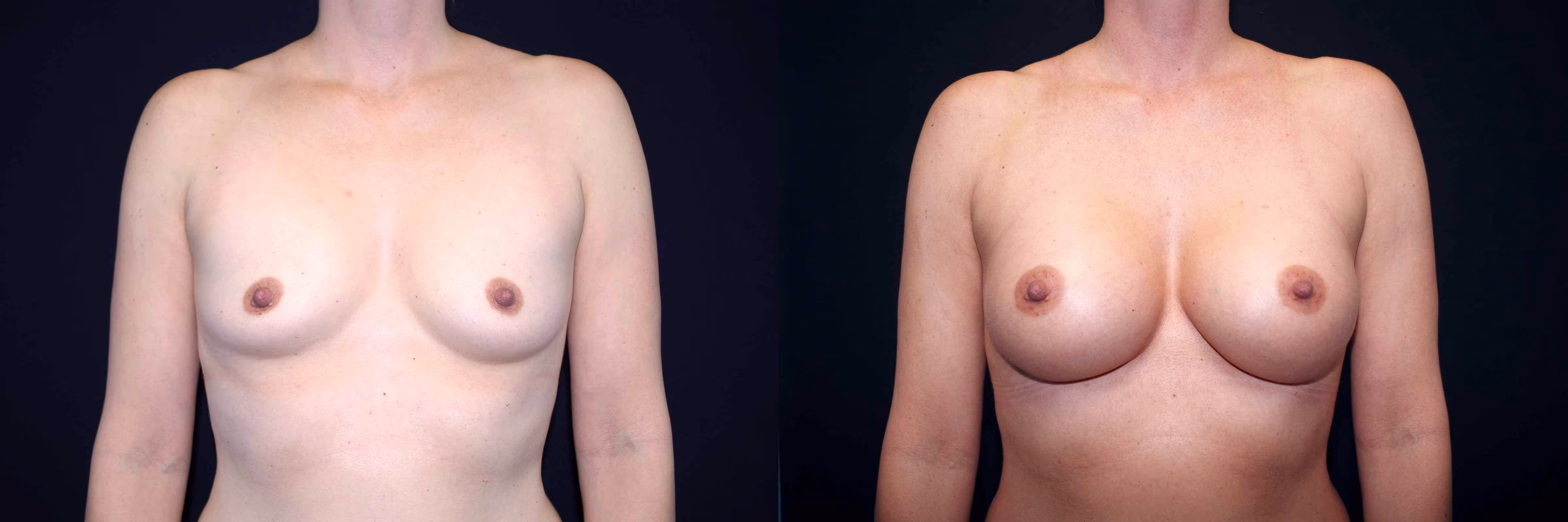Before And After Patient Image