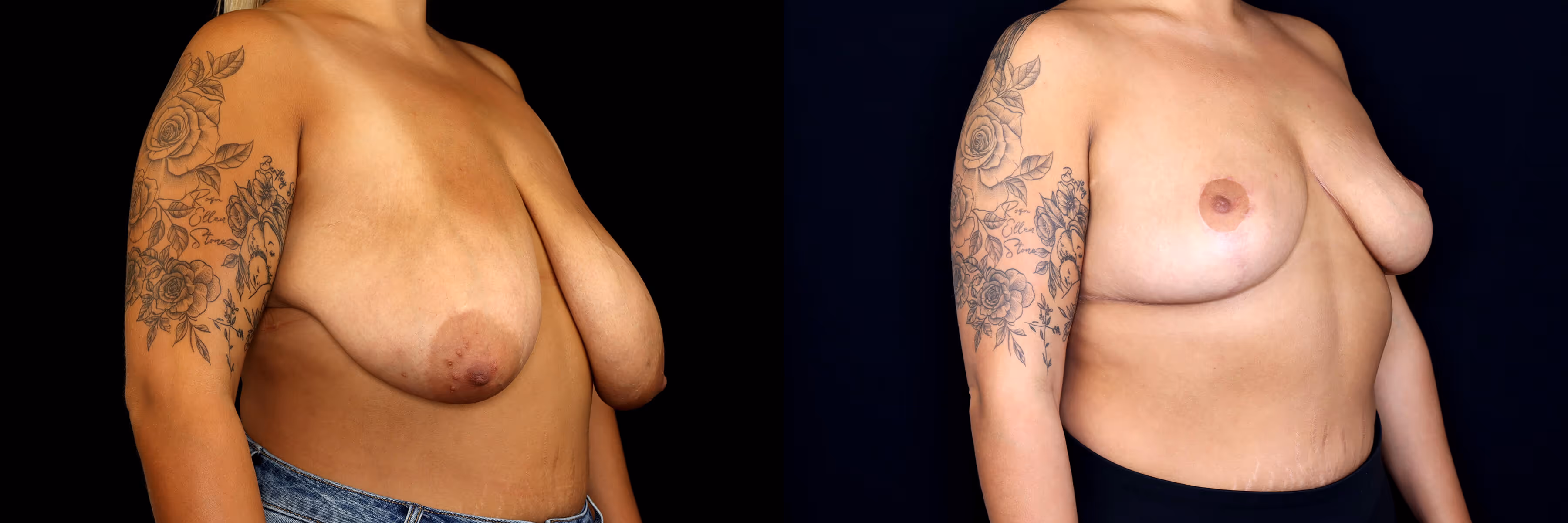 Before And After Patient Image