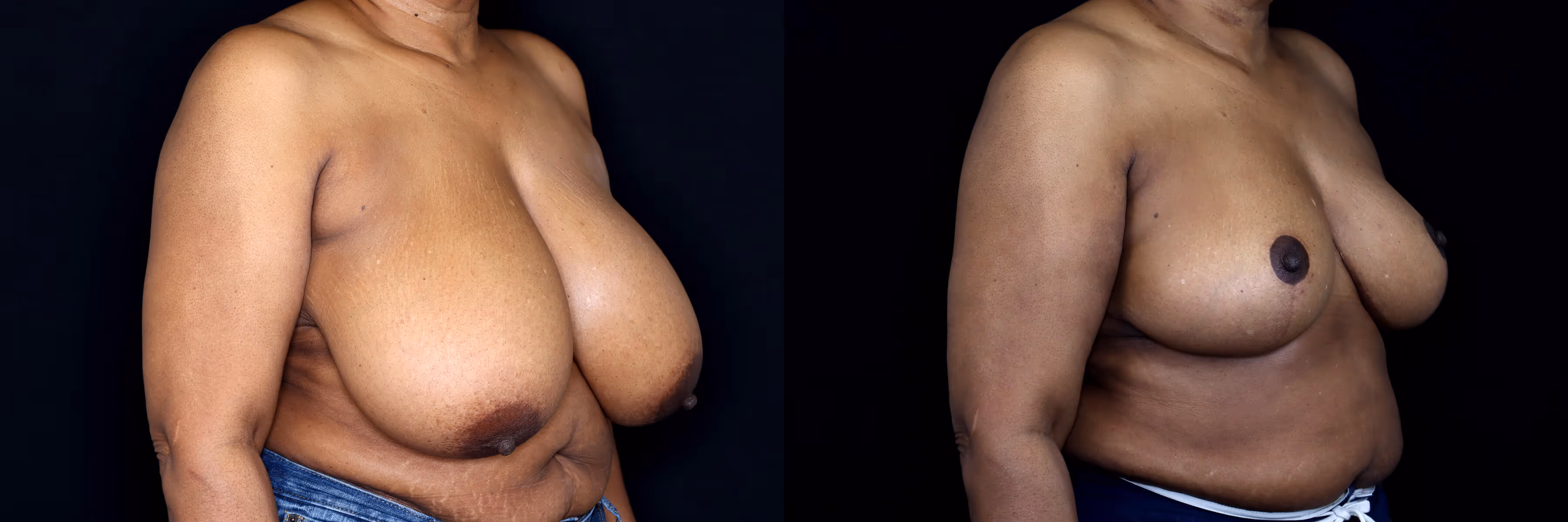 Before And After Patient Image