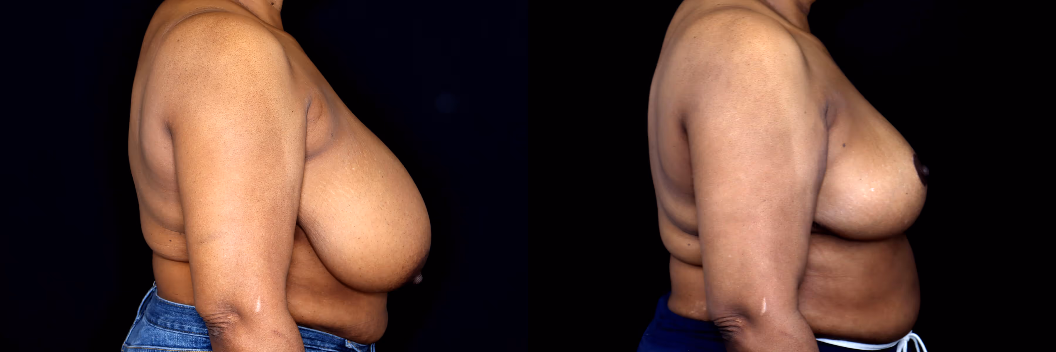 Before And After Patient Image