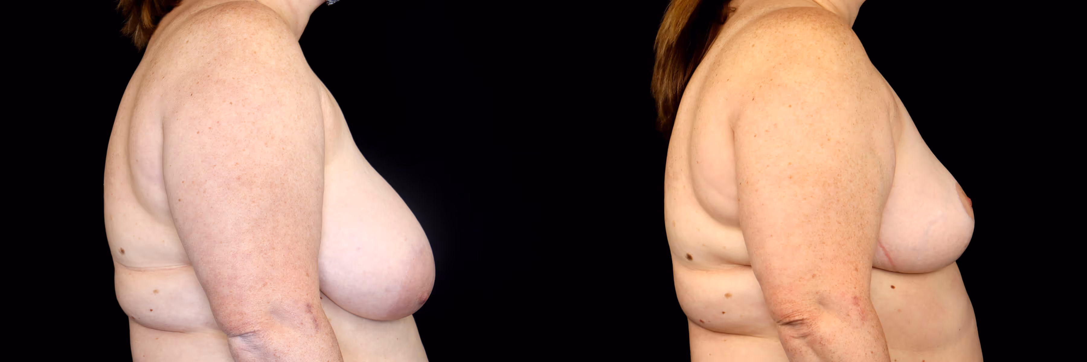 Before And After Patient Image