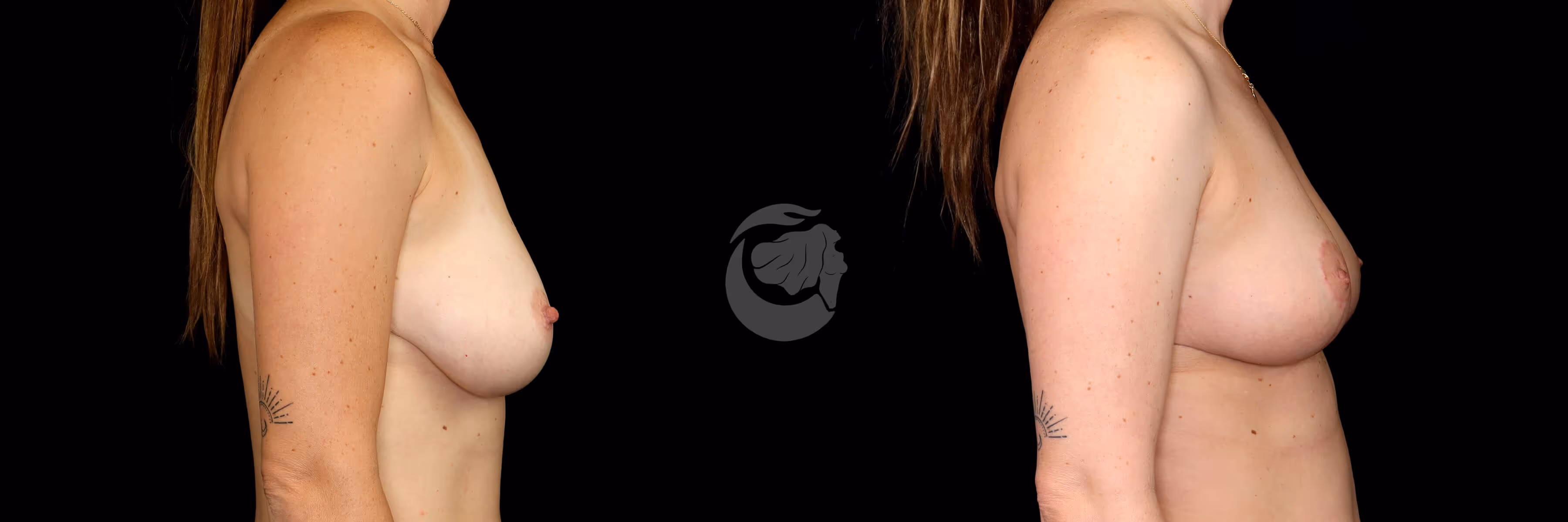 Before And After Patient Image