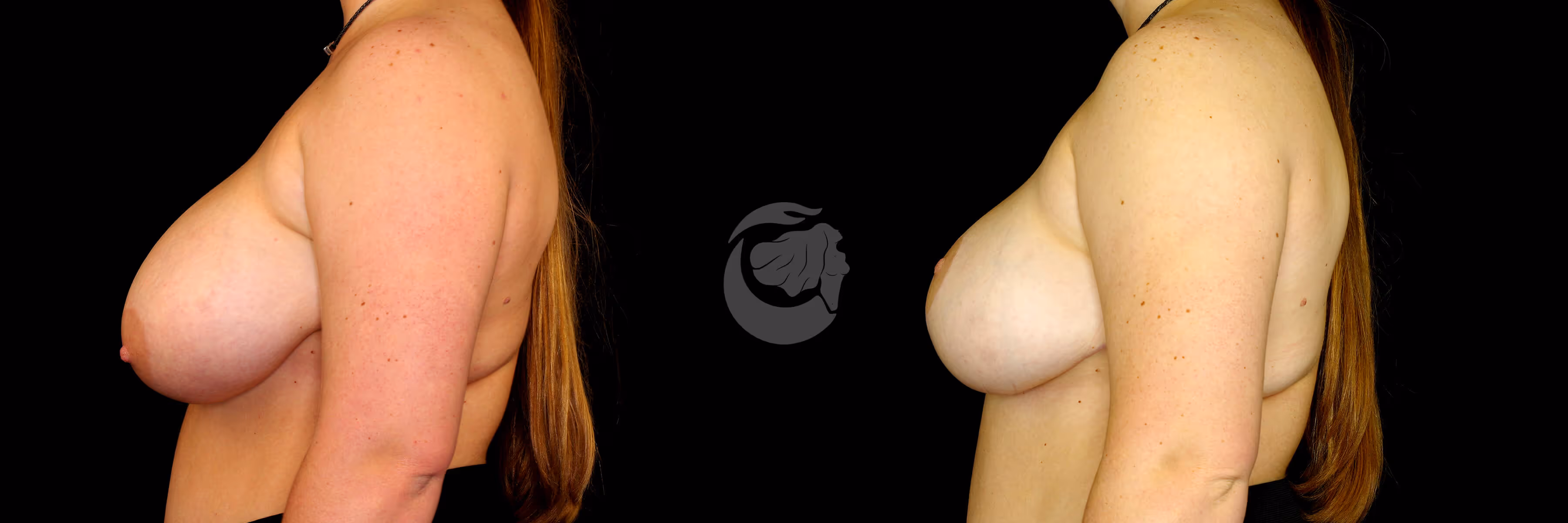 Before And After Patient Image