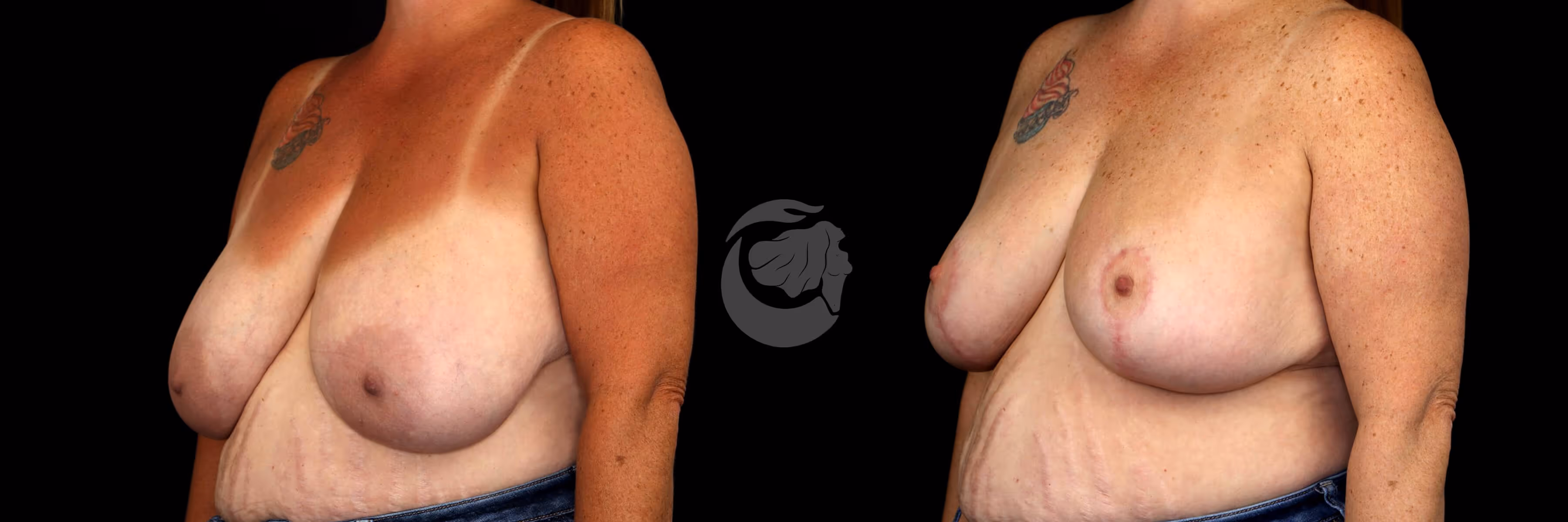 Before And After Patient Image
