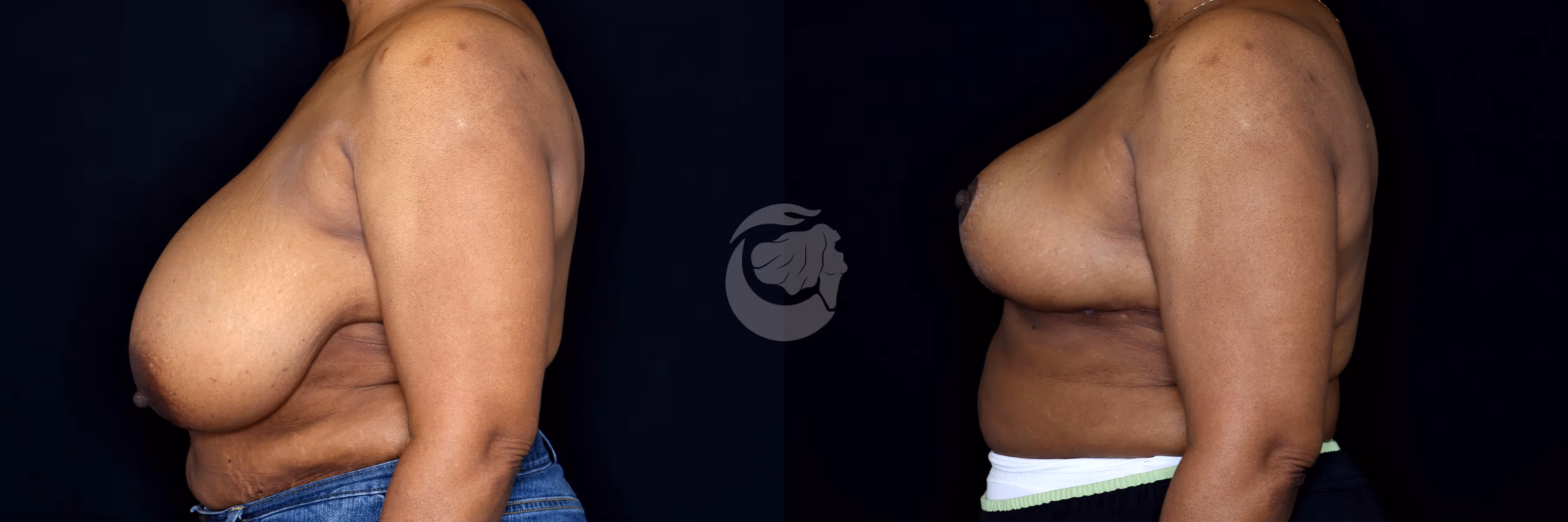 Before And After Patient Image
