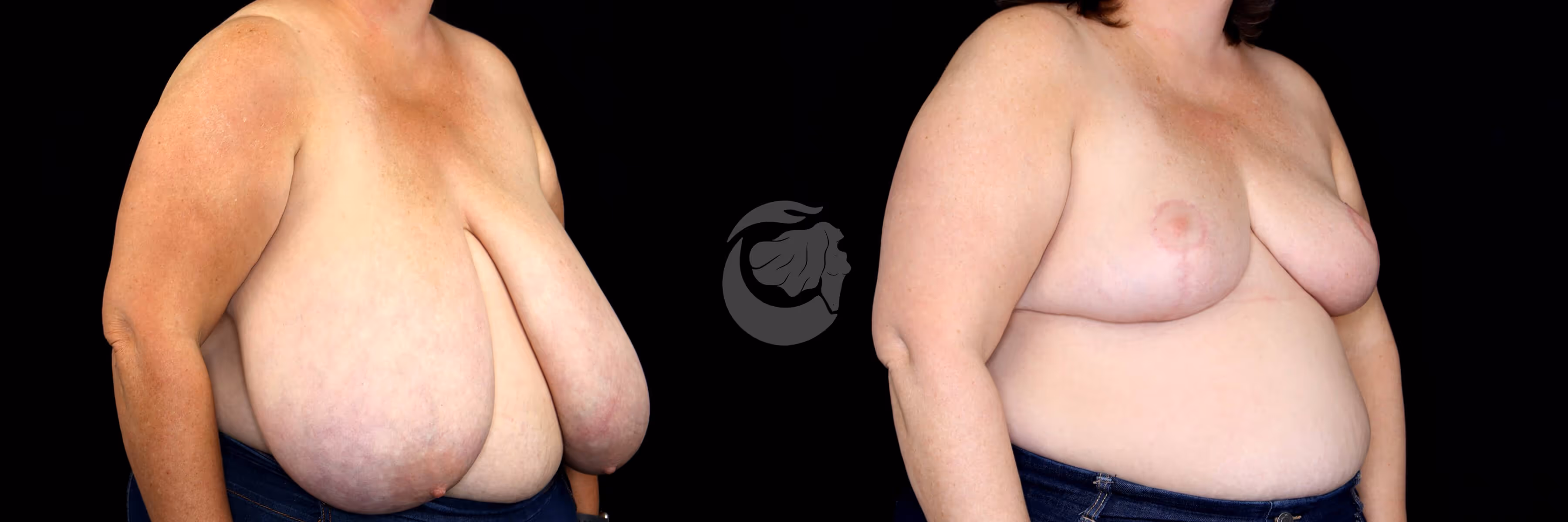 Before And After Patient Image