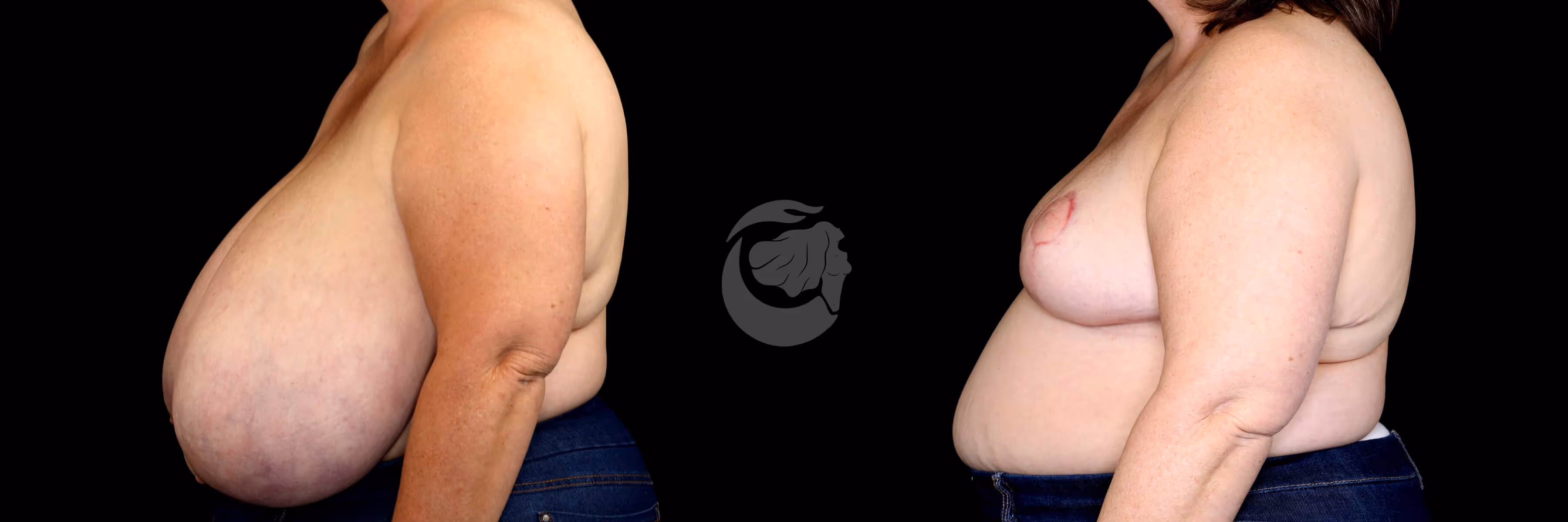 Before And After Patient Image