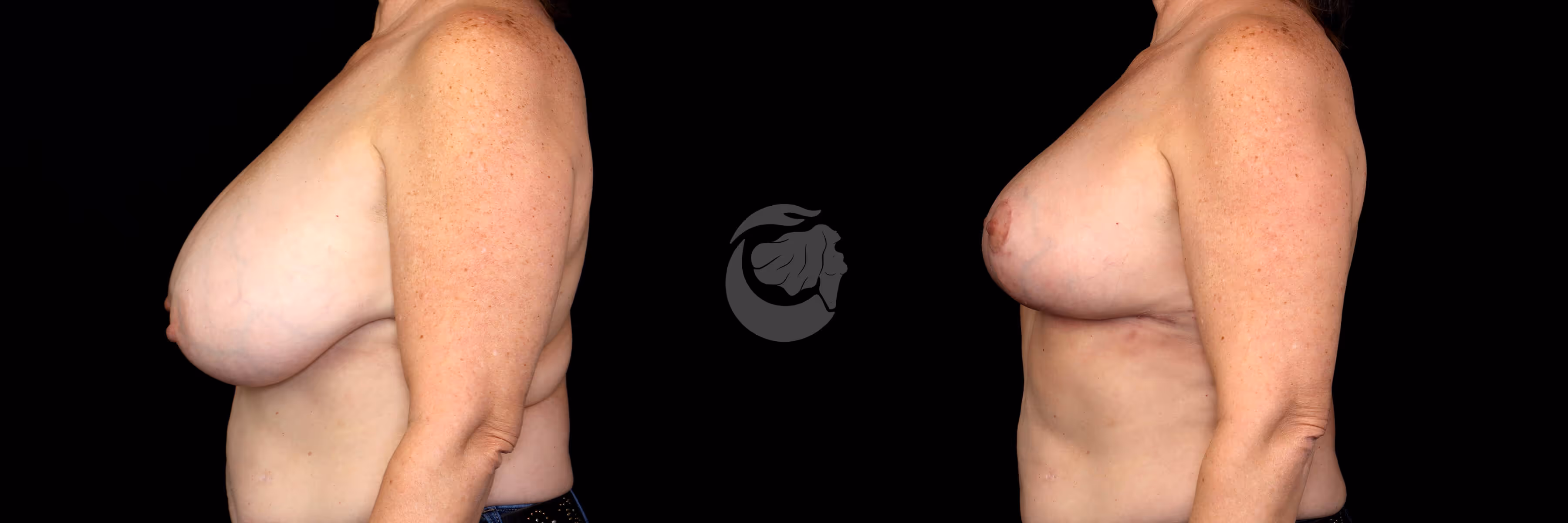 Before And After Patient Image