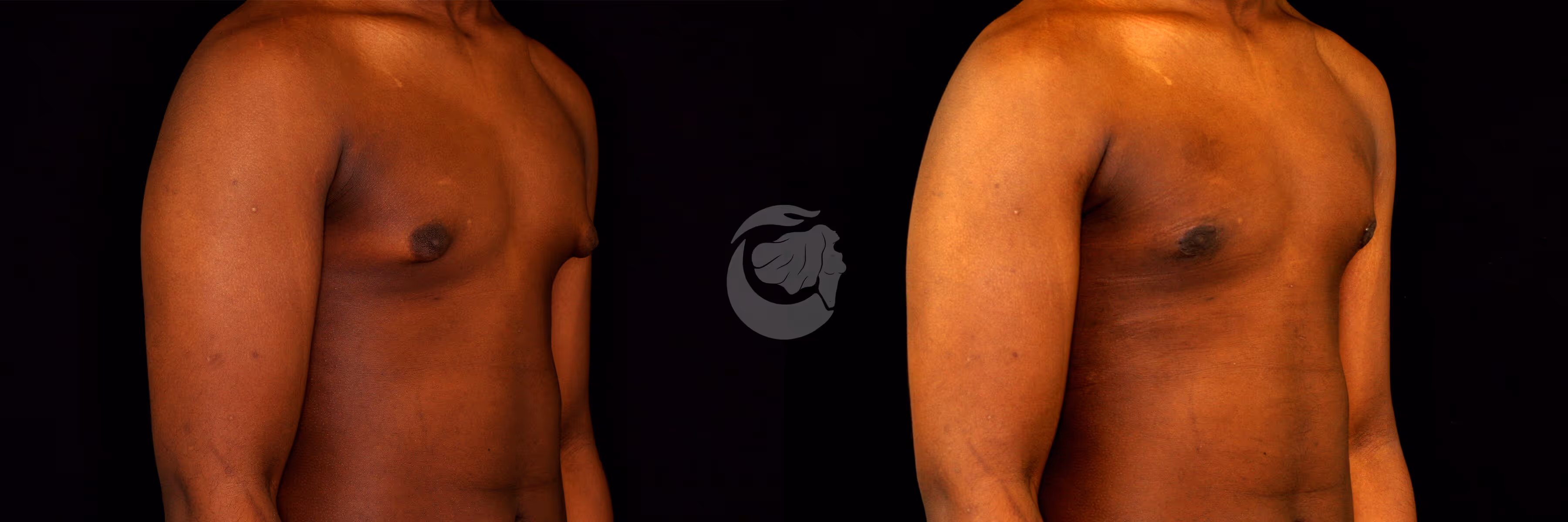 Before And After Patient Image