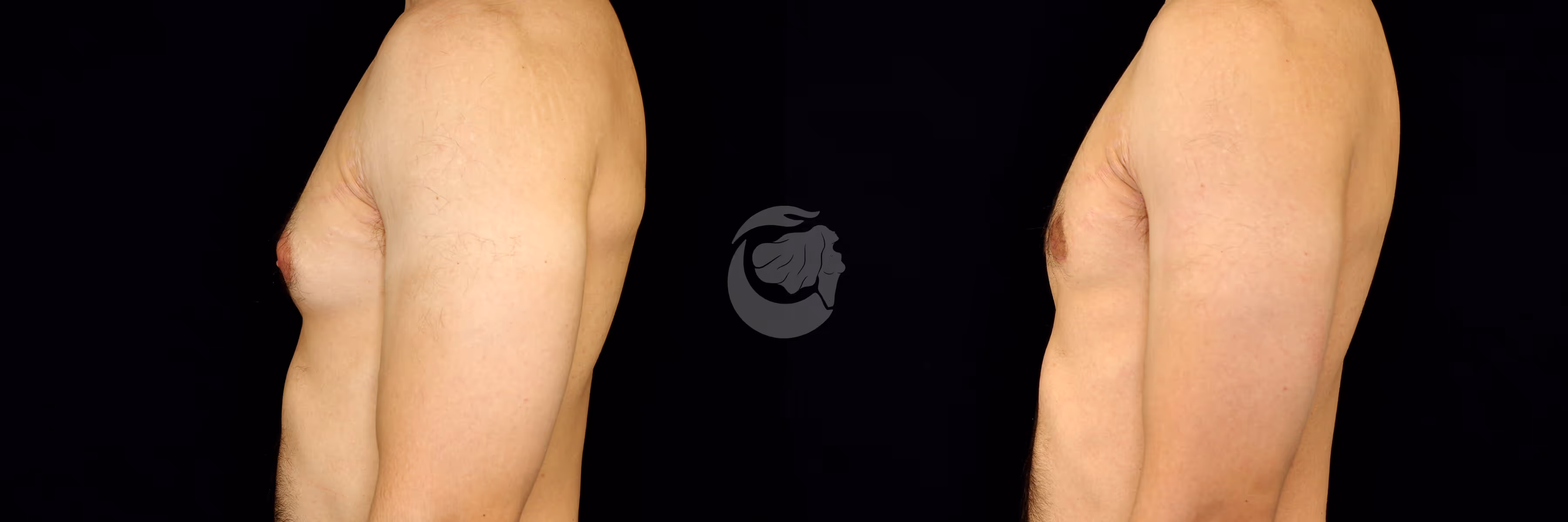 Before And After Patient Image