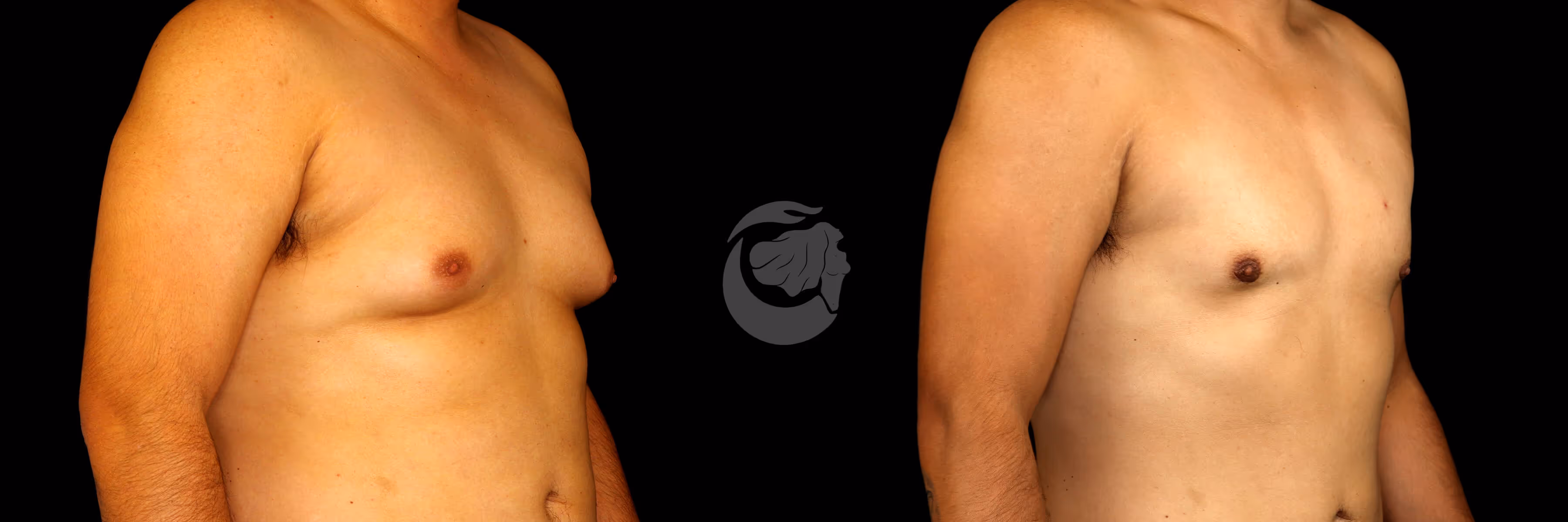 Before And After Patient Image