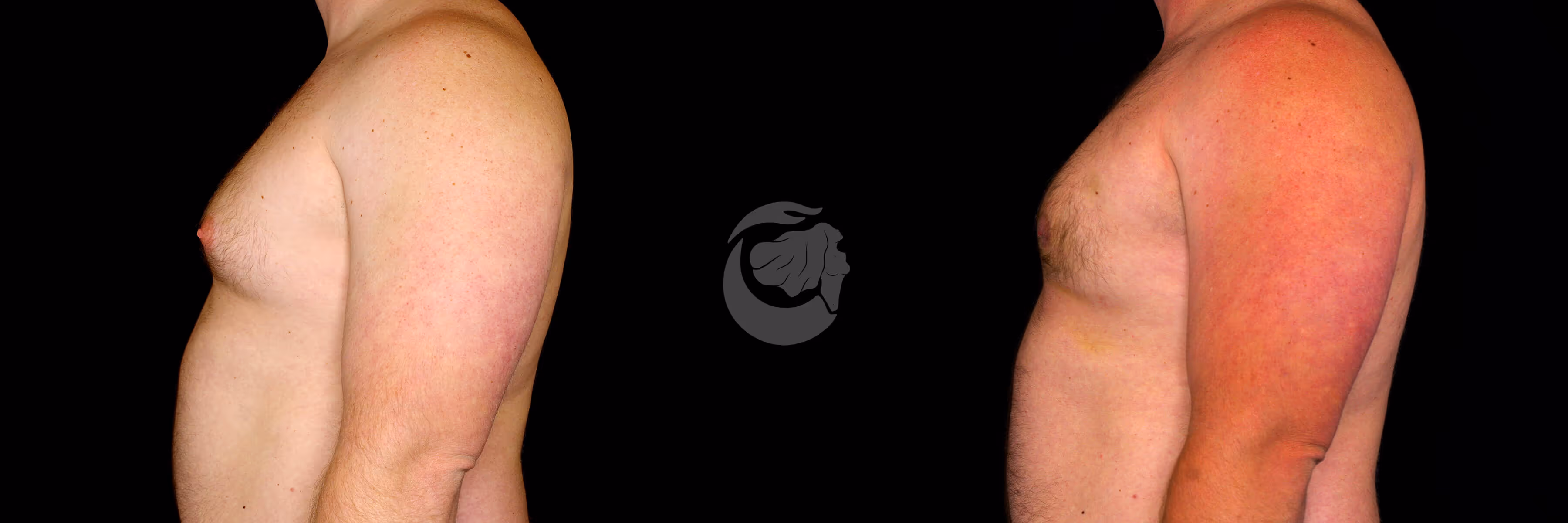 Before And After Patient Image