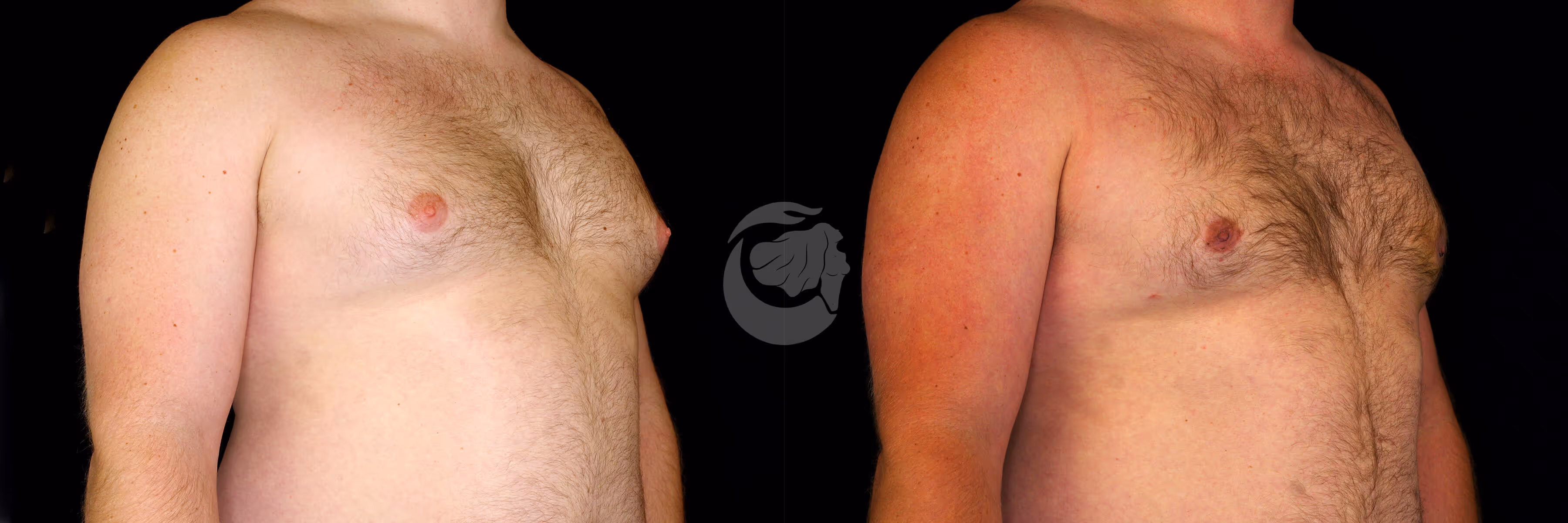Before And After Patient Image