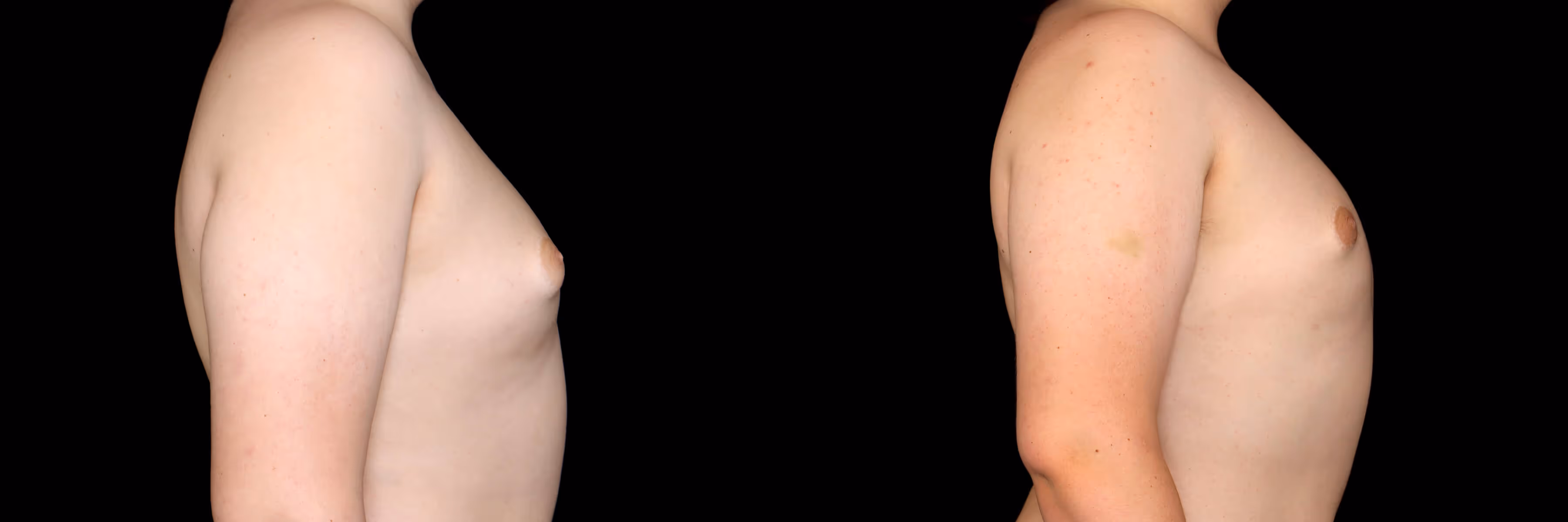 Before And After Patient Image