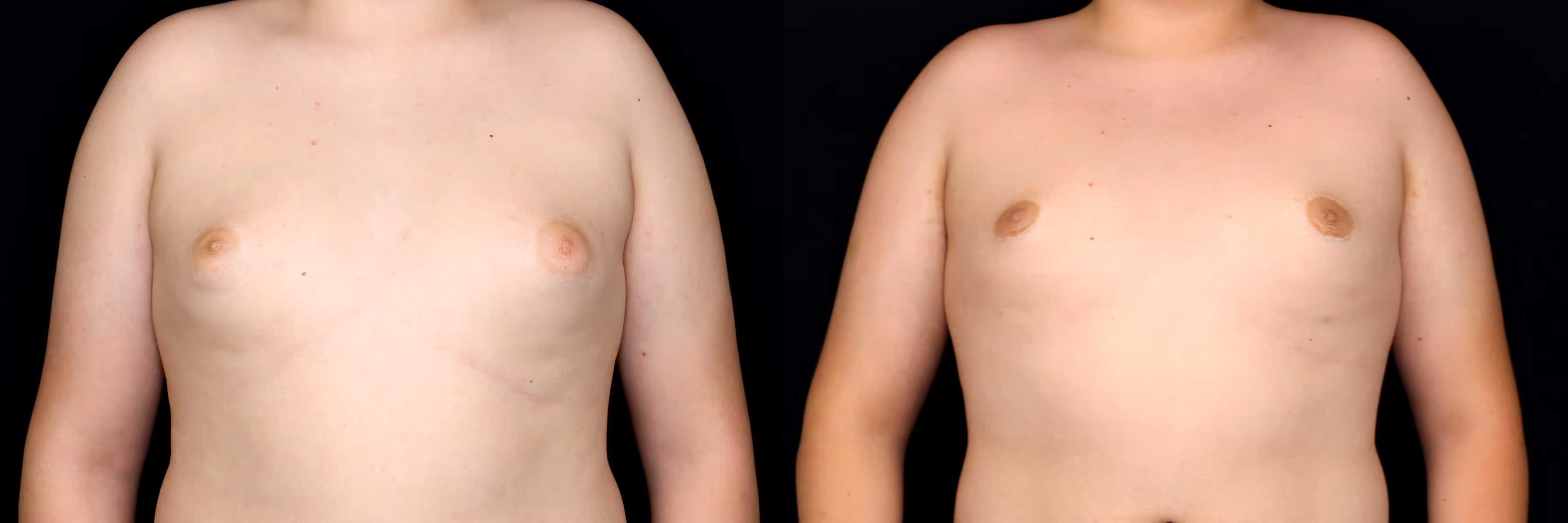 Before And After Patient Image