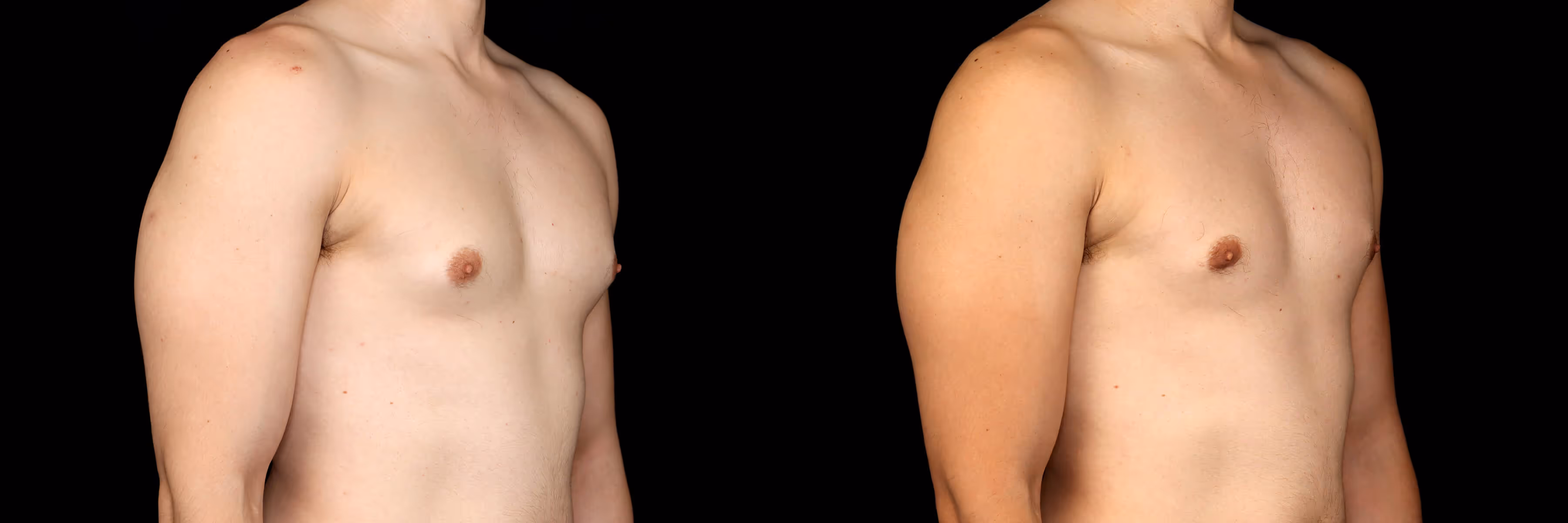 Before And After Patient Image