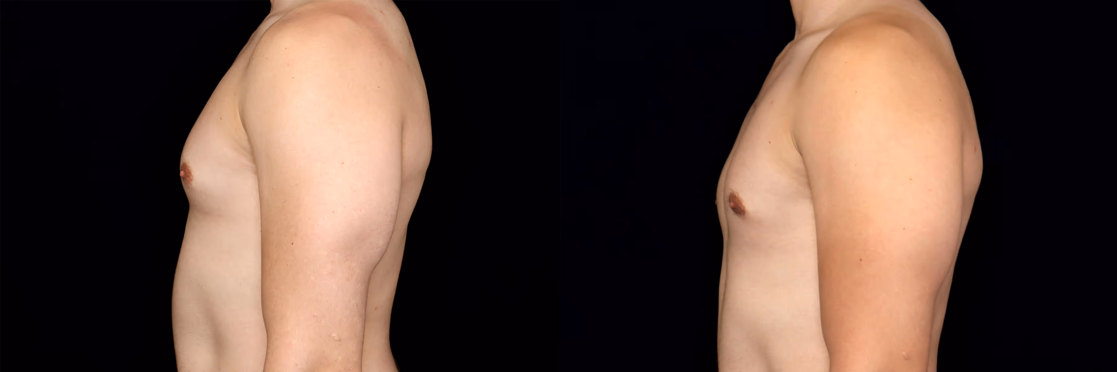 Before And After Patient Image