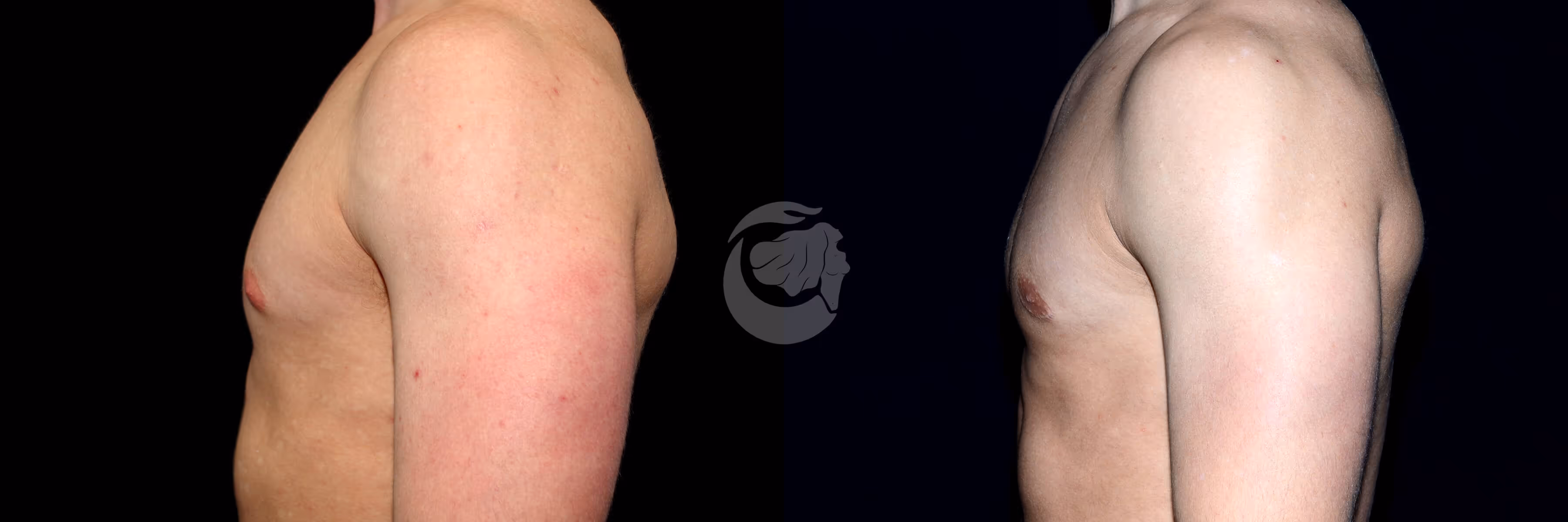Before And After Patient Image