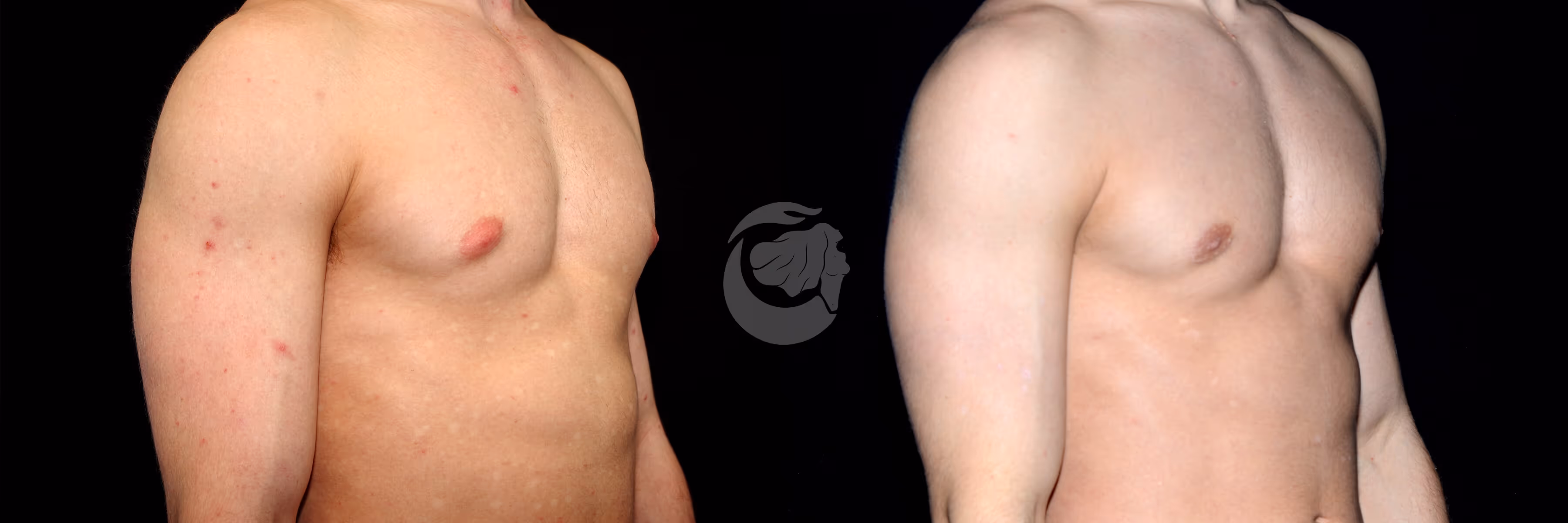 Before And After Patient Image