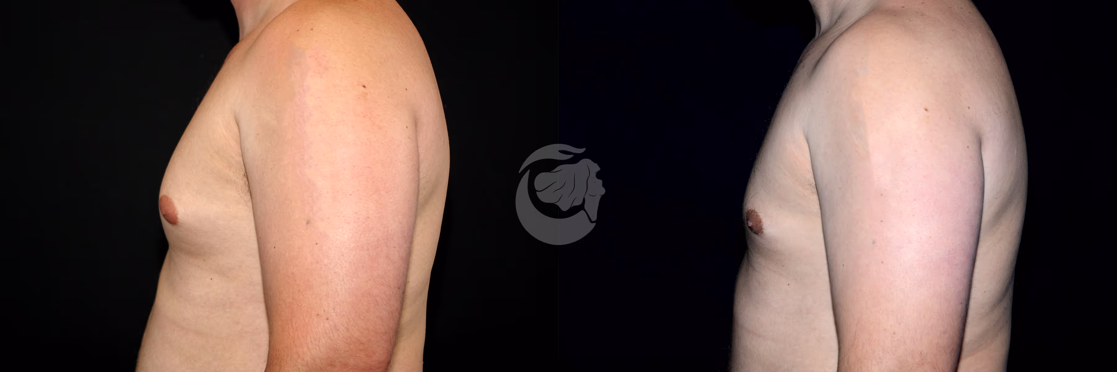 Before And After Patient Image