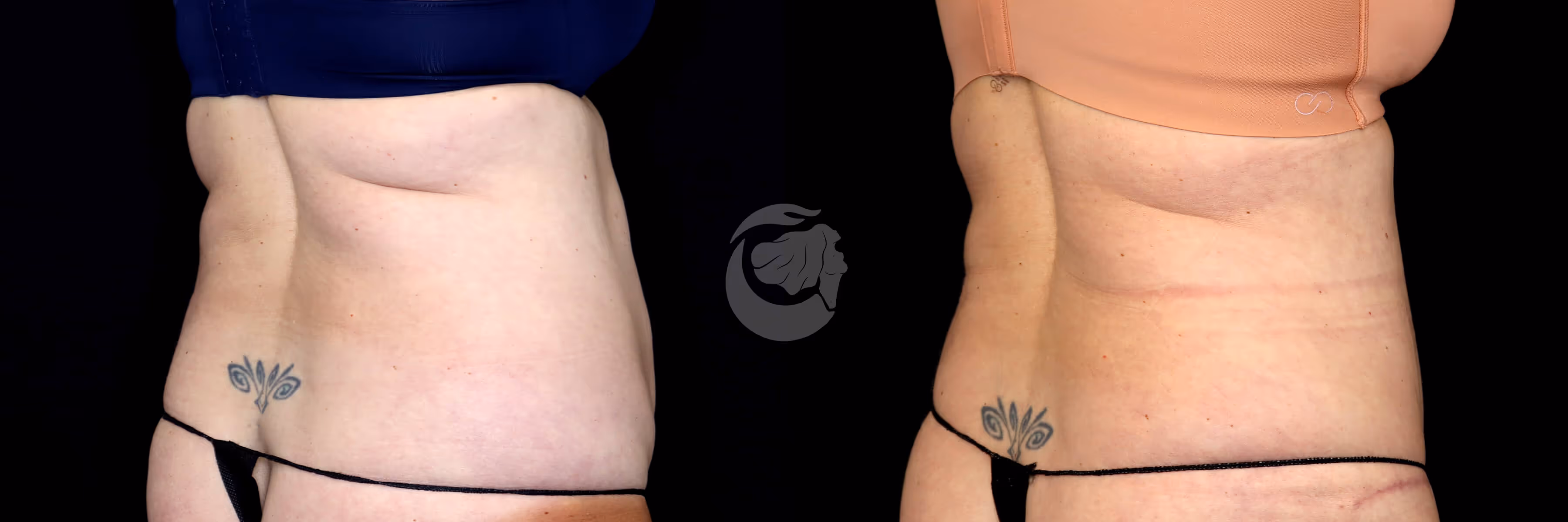 Before And After Patient Image