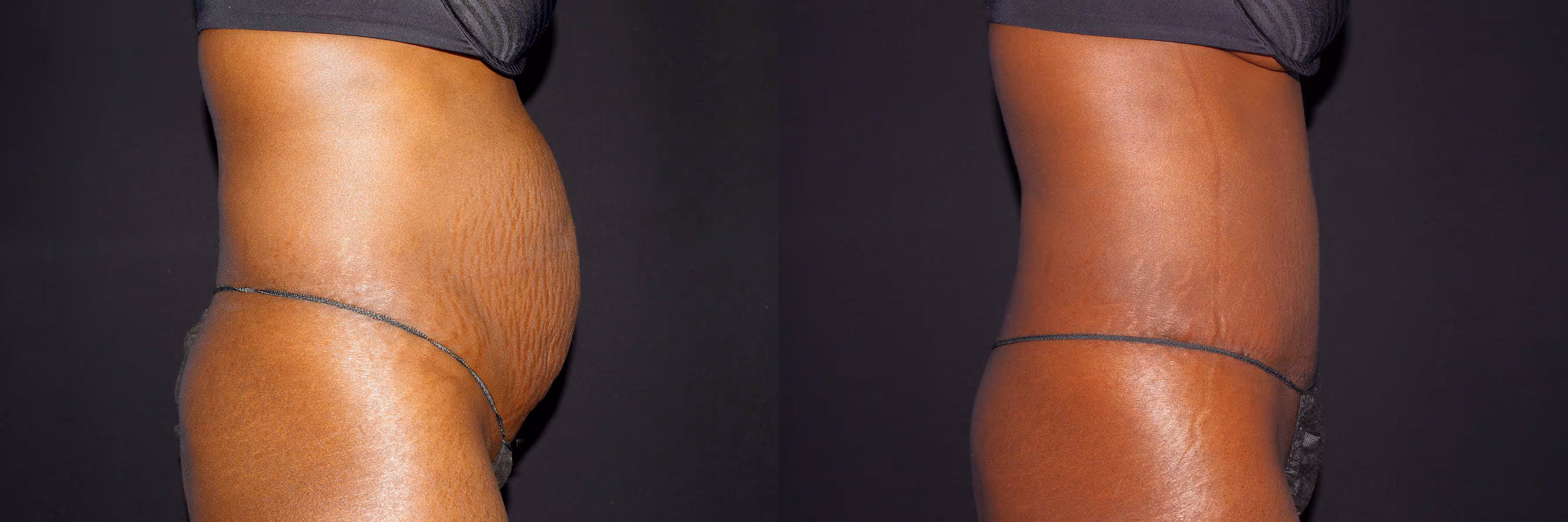 Before And After Patient Image