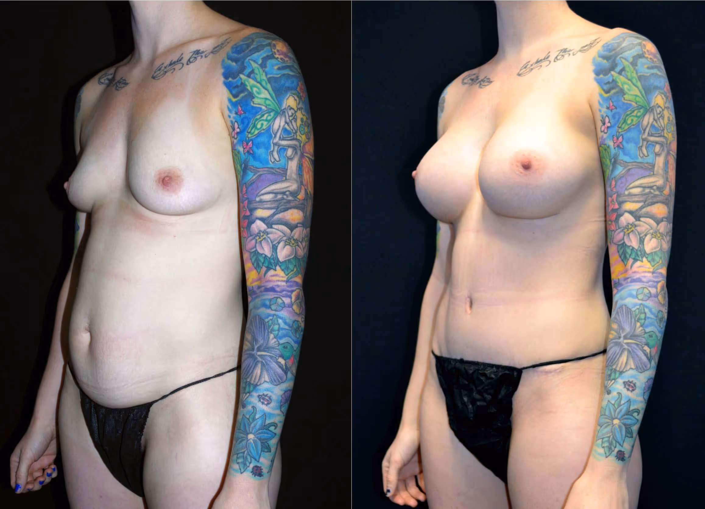 Before And After Patient Image