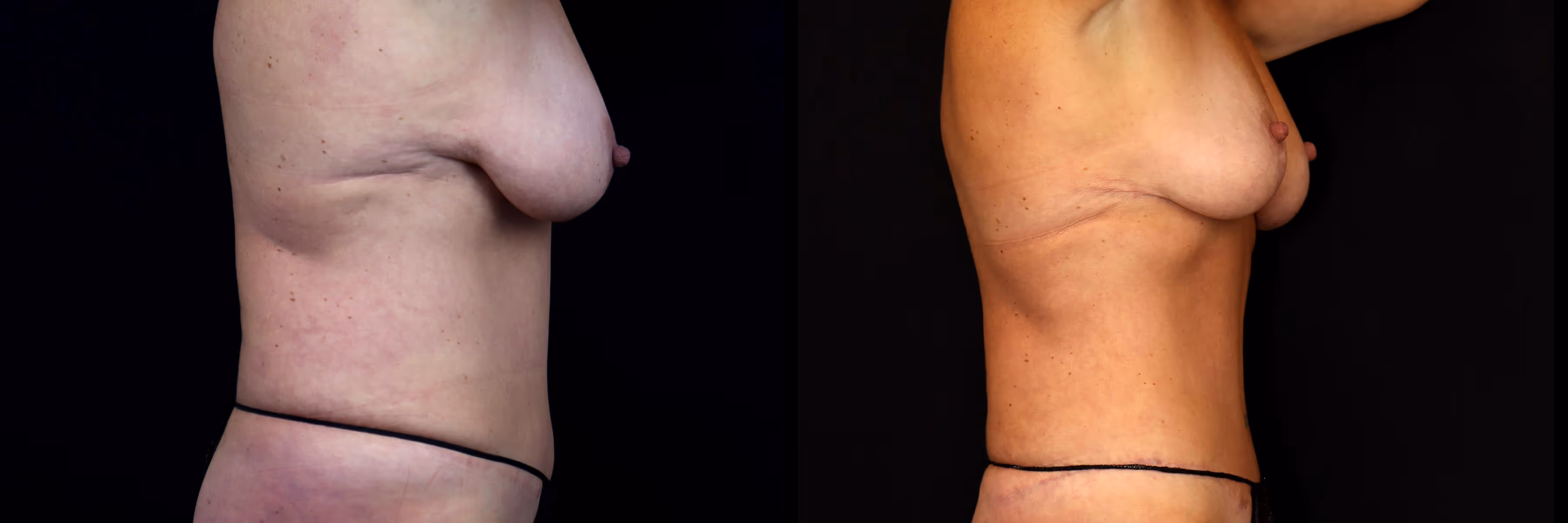Before And After Patient Image