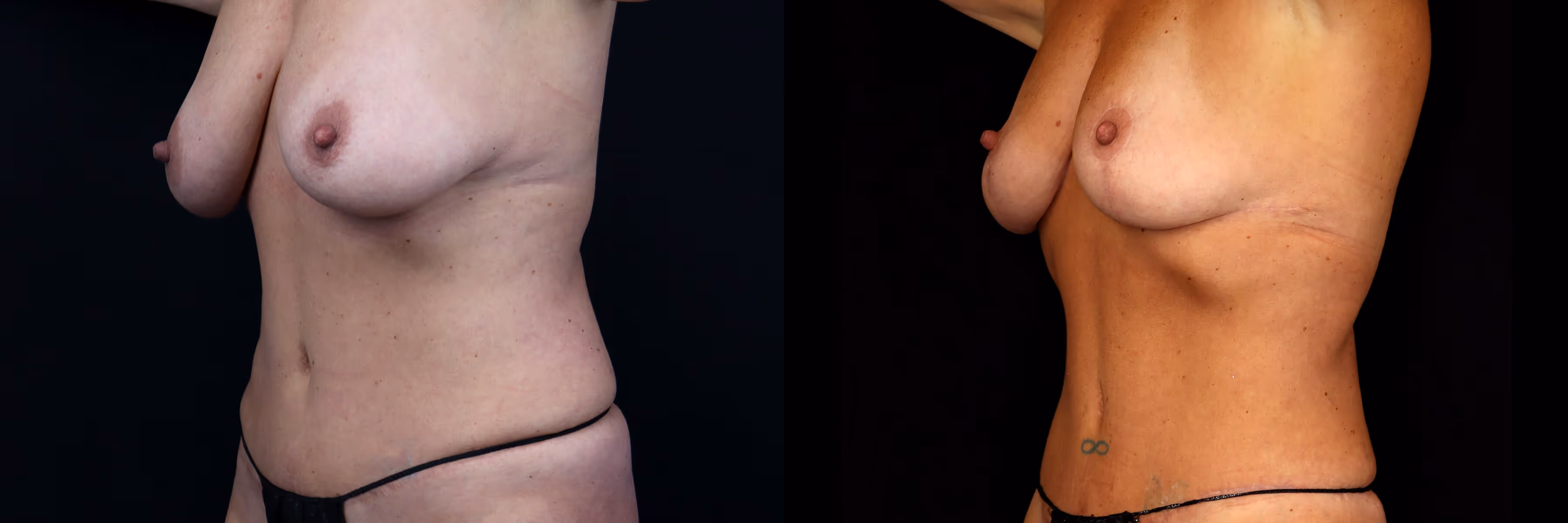 Before And After Patient Image