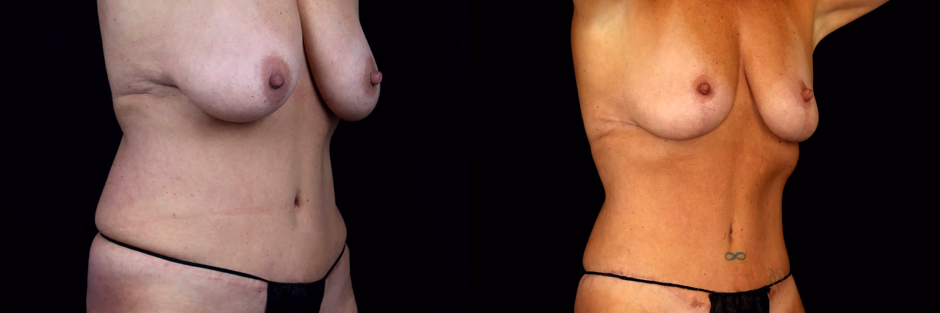 Before And After Patient Image