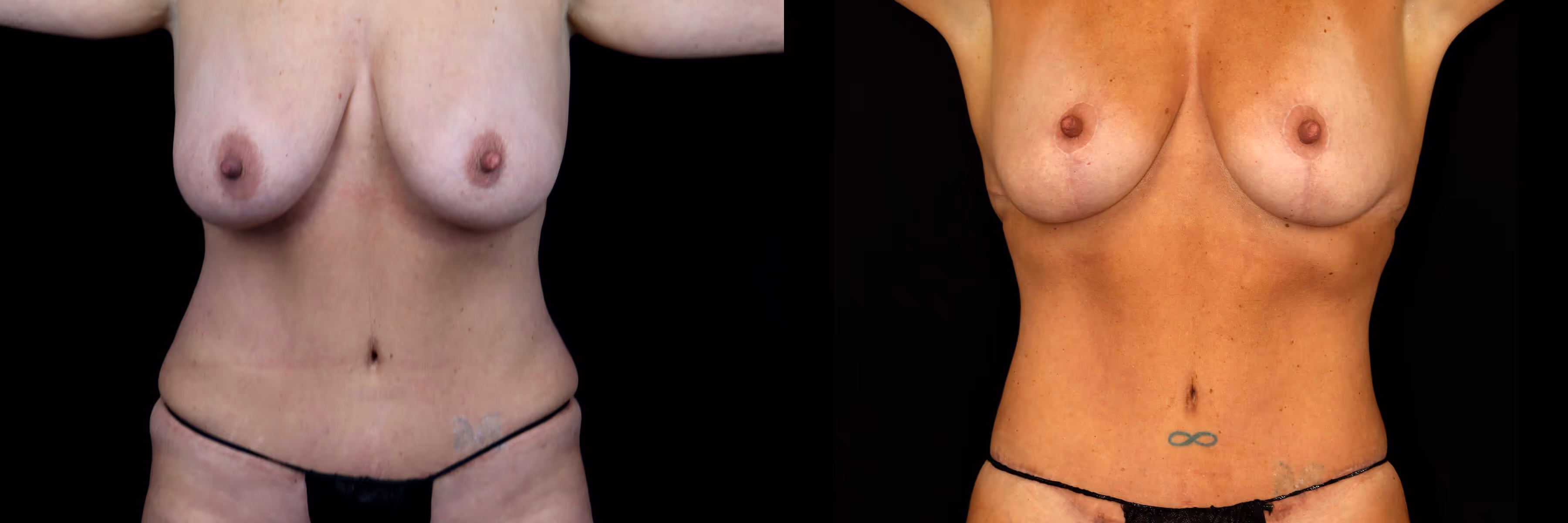 Before And After Patient Image