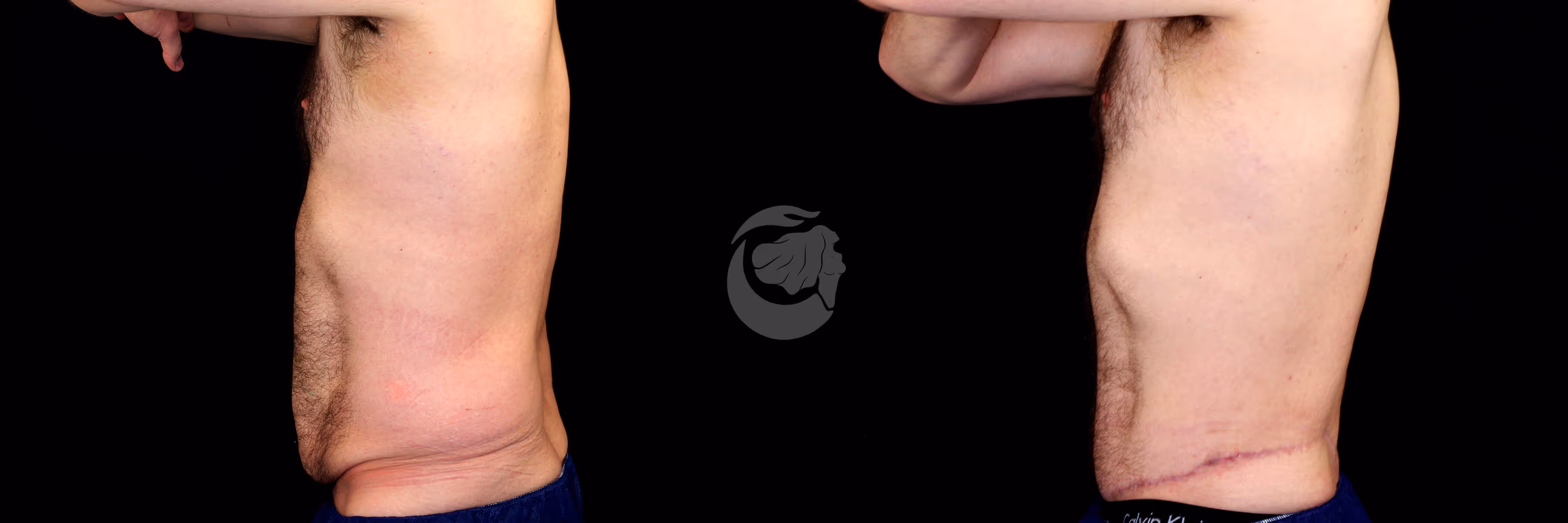 Before And After Patient Image