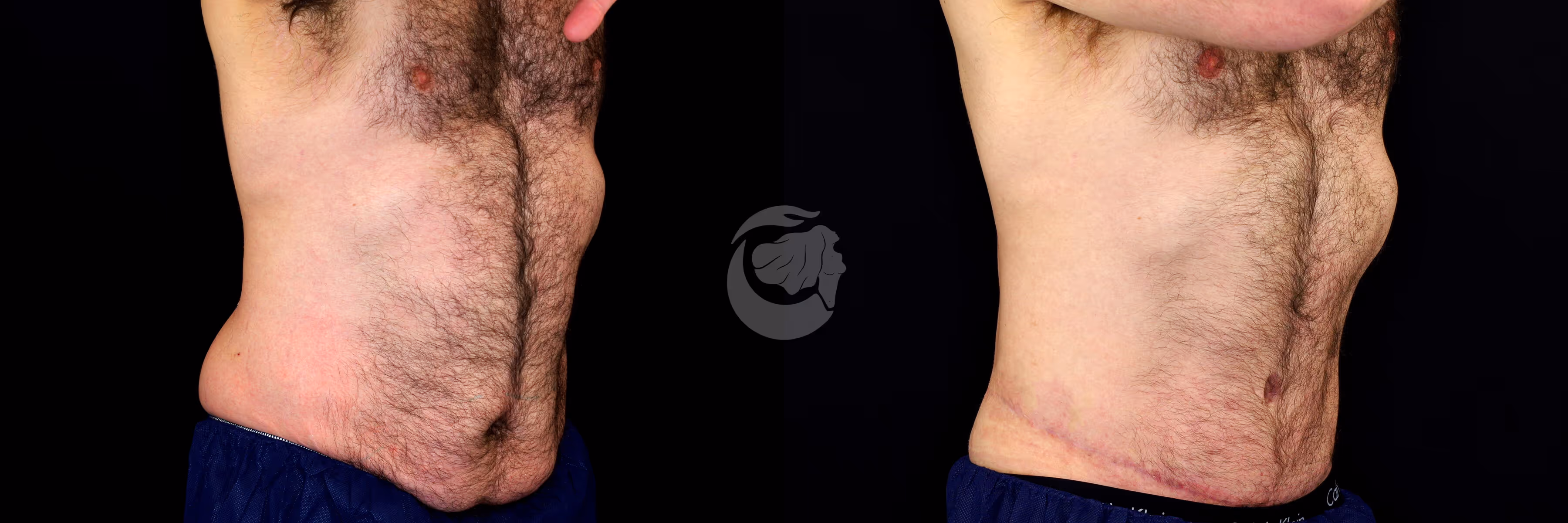 Before And After Patient Image