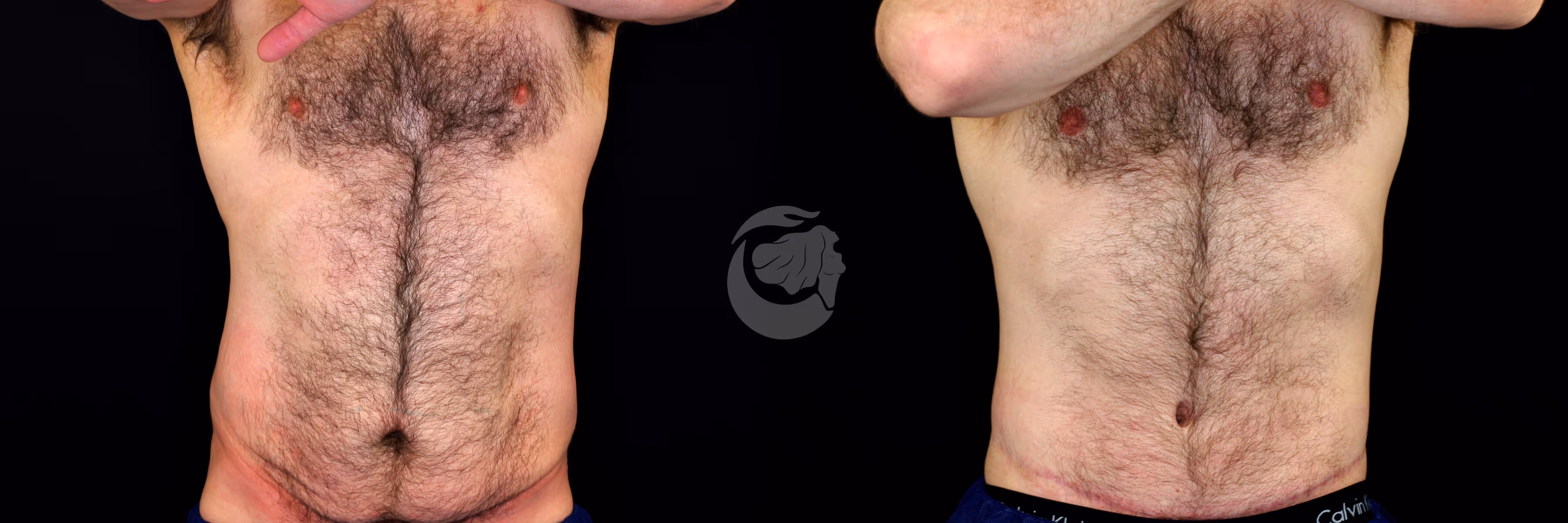 Before And After Patient Image