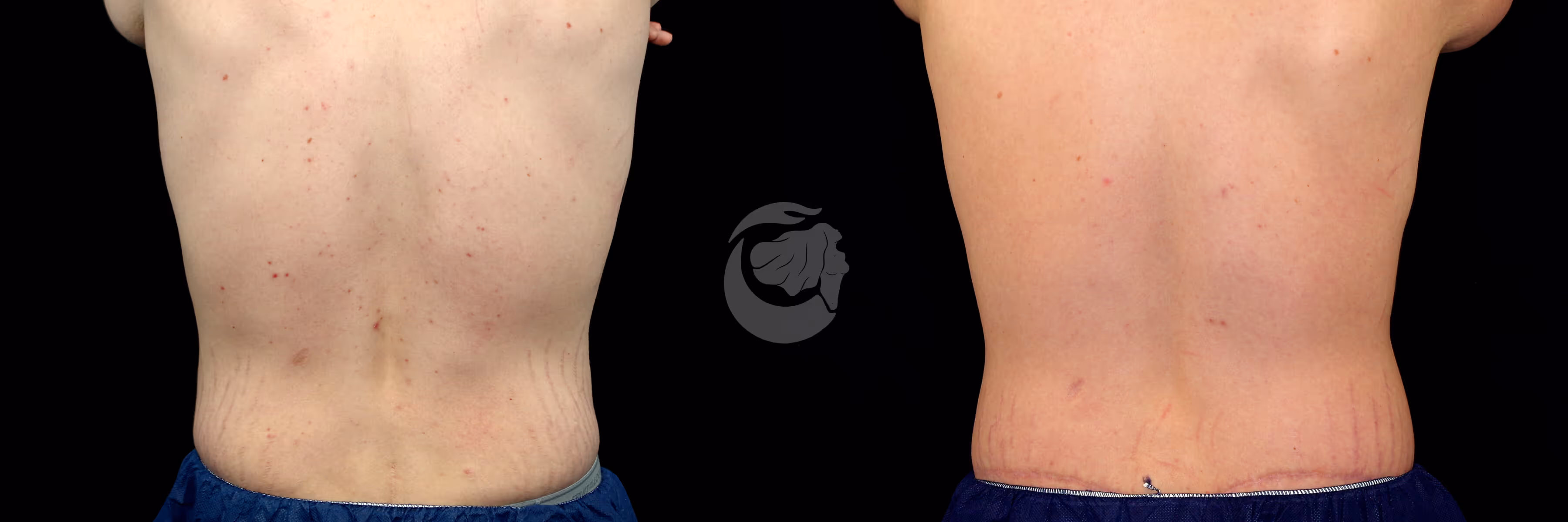 Before And After Patient Image