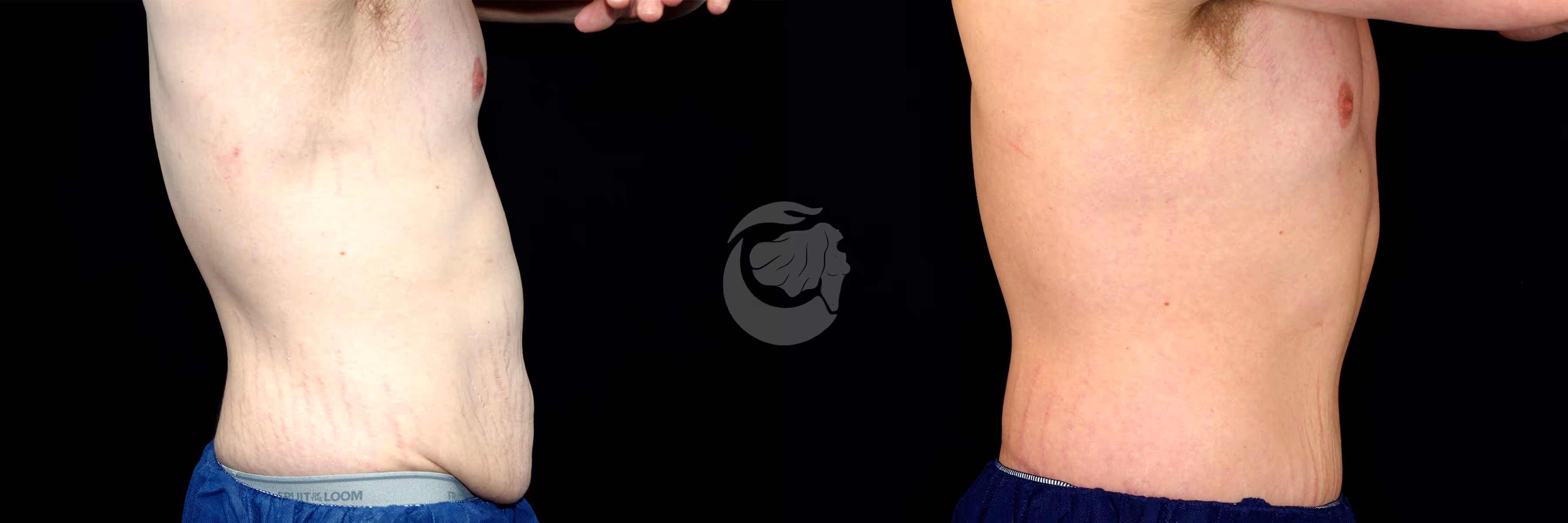 Before And After Patient Image