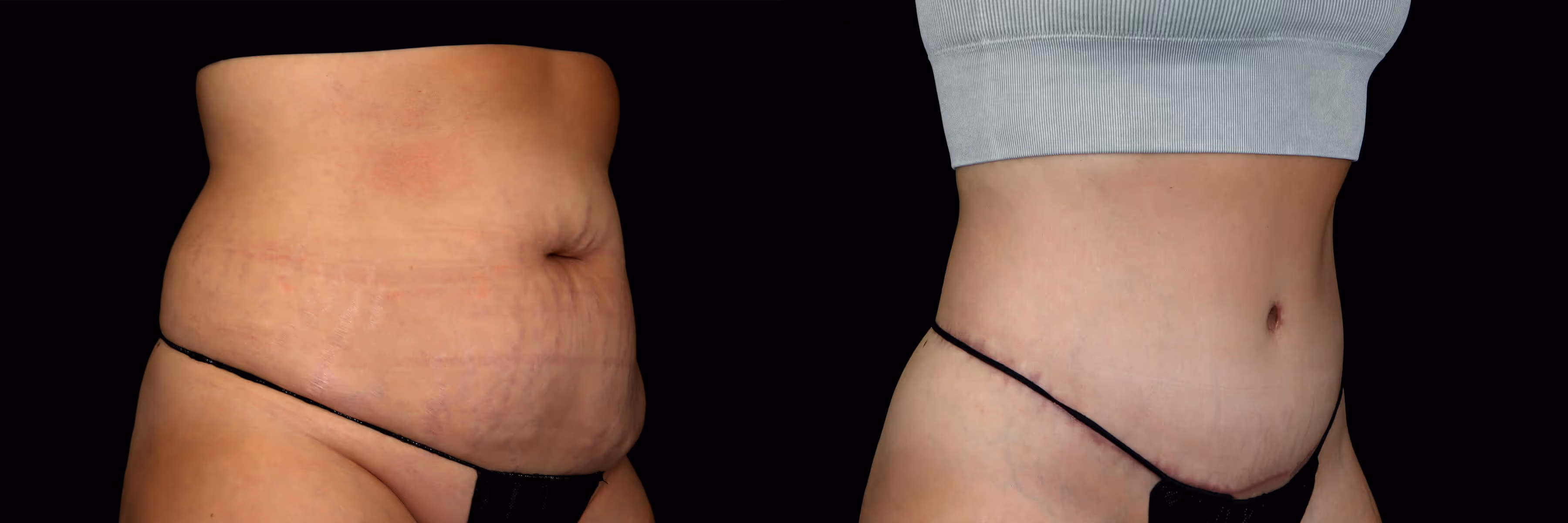 Before And After Patient Image