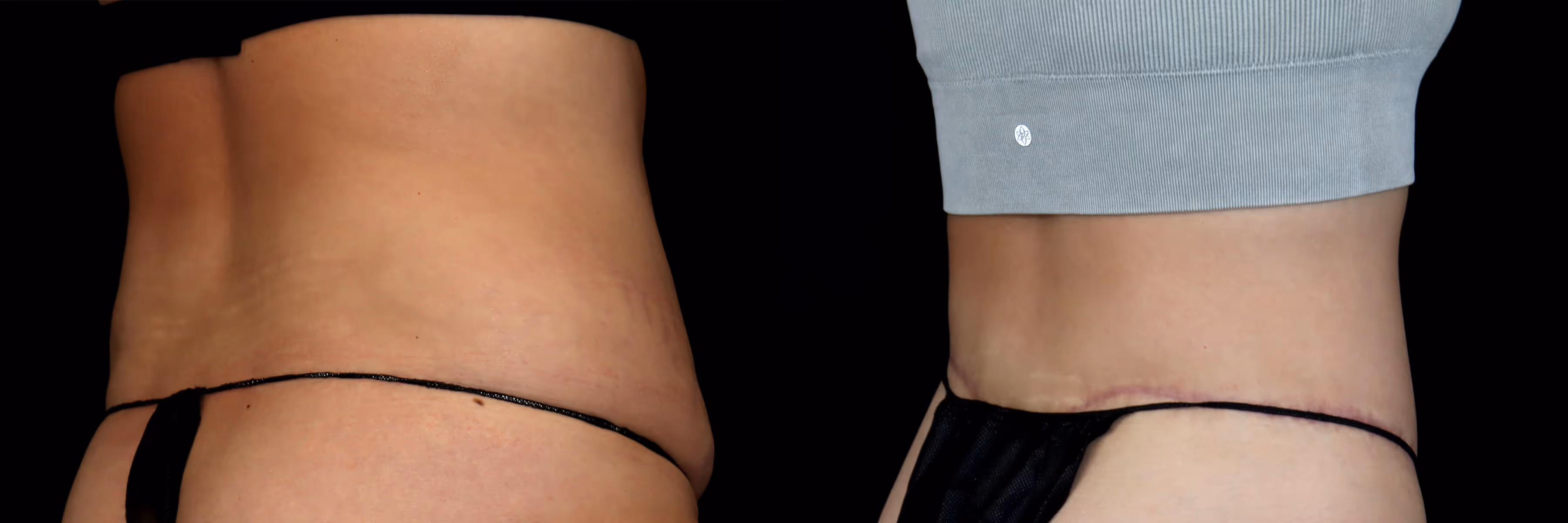 Before And After Patient Image